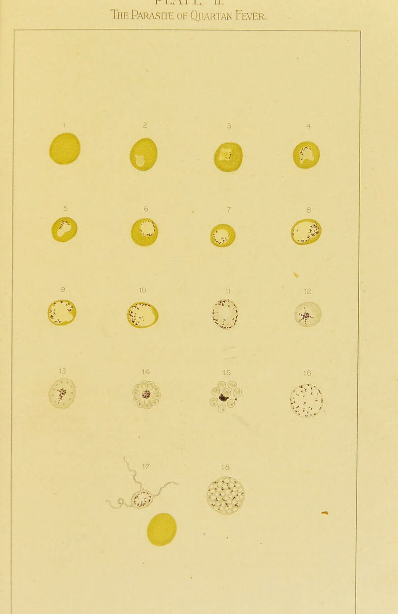 I I U \ I I . II. The Parasite of Qjuartan Fever i 9 6 10 3 4 a 16 U /. -' 17 18