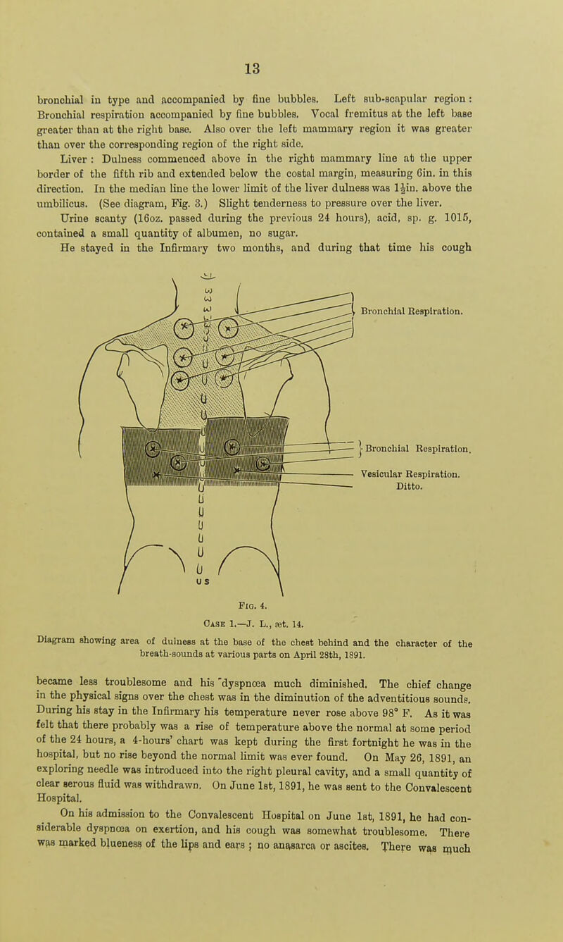 bronchial in type and jiccompanied by fine bubbles. Left sub-scapular region: Bronchial respiration accompanied by fine bubbles. Vocal fremitus at the left base greater than at the right base. Also over the left mammary region it was greater than over the corresponding region of the right side. Liver : Duluess commenced above in the right mammary line at the upper border of the fifth rib and extended below the costal margin, measuring Gin. in this direction. In the median line the lower limit of the liver dulness was 1 Jin. above the umbilicus. (See diagram, Fig. 3.) Slight tenderness to pressure over the liver. Urine scanty (16oz. passed during the previous 24 hours), acid, sp. g. 1015, contained a small quantity of albumen, no sugar. He stayed in the Infirmary two months, and during that time his cough Bronchial Respiration. j- Bronchial Respiration, Vesicular Respiration. Ditto. FiQ. 4. Case 1.—J. L., ret. 14. Diagram showing area of dulness at the base of the cheat behind and the character of the breath-sounds at various parts on April 28th, 1891. became less troublesome and his 'dyspnoea much diminished. The chief change in the physical signs over the chest was in the diminution of the adventitious sounds. During his stay in the Infirmary his temperature never rose above 98° F. As it was felt that there probably was a rise of temperature above the normal at some period of the 24 hours, a 4-hours' chart was kept during the first fortnight he was in the hospital, but no rise beyond the normal limit was ever found. On May 26, 1891, an exploring needle was introduced into the right pleural cavity, and a small quantity of clear serous fluid was withdrawn. On June 1st, 1891, he was sent to the Convalescent Hospital. On his admission to the Convalescent Hospital on June 1st, 1891, he had con- siderable dyspnoea on exertion, and his cough was somewhat troublesome. There was marked bjueness of the lips and ears ; no anasarca or ascites. There was iquch