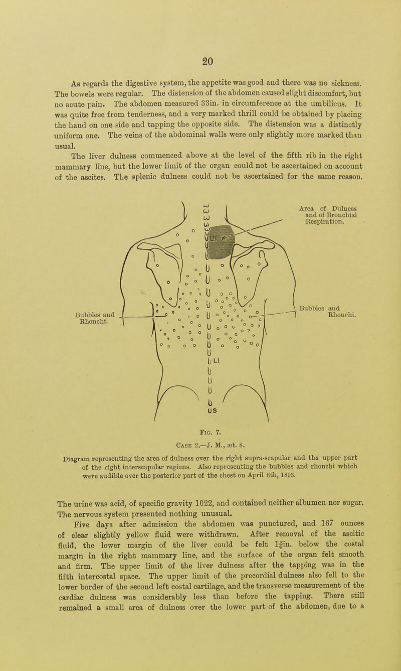 As regards tlie digestive system, the appetite was good and there was no sickness. Tlie bowels were regular. The distension of the abdomen caused slight discomfort, but no acute pain. The abdomen measured 33in. in circumference at the umbilicus. It was quite free from tenderness, and a very marked thrill could be obtained by placing the hand on one side and tapping the opposite side. The distension was a distinctly uniform one. The veins of the abdominal walls were only slightly more marked than usual. The liver dulness commenced above at the level of the fifth rib in the right mammary line, but the lower limit of the organ could not be ascertained on account of the ascites. The splenic dulness could not be ascertained for the same reason. Area of Dulness and of Bronchial llosplration. Bubbles and Rhonolii. Fig. 7. Case 2.—J. M., xt S. Diagram representing the area of dulness over the right supra-scapular and the upper part of the right interscapular regions. Also representing the bubbles and rhonchi which were audible over the posterior part of the chest on April 8th, 1893. The urine was acid, of specific gravity 1022, and contained neither albumen nor sugar. I'he nervous system presented nothing unusual. Five days after admission the abdomen was punctured, and 167 ounces of clear slightly yellow fluid were withdrawn. After removal of the ascitic fluid, the lower margin of the Uver could be felt Ifin. below the costal margin in the right mammary line, and the surface of the organ felt smooth and firm. The upper limit of the liver dulness after the tapping was in the fifth intercostal space. The upper limit of the precordial dulness also fell to the lower border of the second left costal cartilage, and the transverse measurement of the cardiac dulness was considerably less than before the tapping. There still remained a small area of dulness over the lower part of the abdomen, due to a
