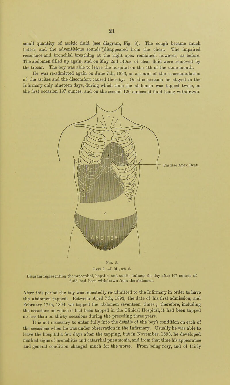 small quantity of ascitic fluid (see diagram, Pig. 8). The cough became much better, and the adventitious sounds'disappeared from the chest. The impaired resonance and bronchial breathing at the right apex remained, however, as before. The abdomen filled up again, and on May 2ud 140oz. of clear fluid were removed by the trocar. The boy was able to leave the hospital on the 4th of the same nionth. He was re-admitted again on June 7th, 1893, an account of the re-accumulation of the ascites and the discomfort caused thereby. On this occasion he stayed in the Infirmary only nineteen days, during which time the abdomen was tapped twice, on the first occasion 197 ounces, and on the second 120 ounces of fluid being withdrawn. Fig. 8. Case 2. -J. M., ajt. 8. Diagram representing the precordial, hepatic, and ascitic duhiess the day after 197 ounces of fluid had been withdrawn from the abdomen. After this period the boy was repeatedly re-admitted to the Infirmary in order to have the abdomen tapped. Between April 7th, 1893, the date of his first admission, and February 17th, 1894, we tapped the abdomen seventeen times ; therefore, including the occasions on which it had been tapped in the Clinical Hospital, it had been tapped no less than on thirty occasions during the preceding three years. It is not necessary to enter fully into the details of the boy's condition on each of the occasions when he was under observation in the Infirmary. Usually he was able to leave the hospital a few days after the tapping, but in November, 1893, he developed marked signs of bronchitis and catarrhal pneumonia, and from that time his appearance and general condition changed much for the worse. From being rosy, and of fairly
