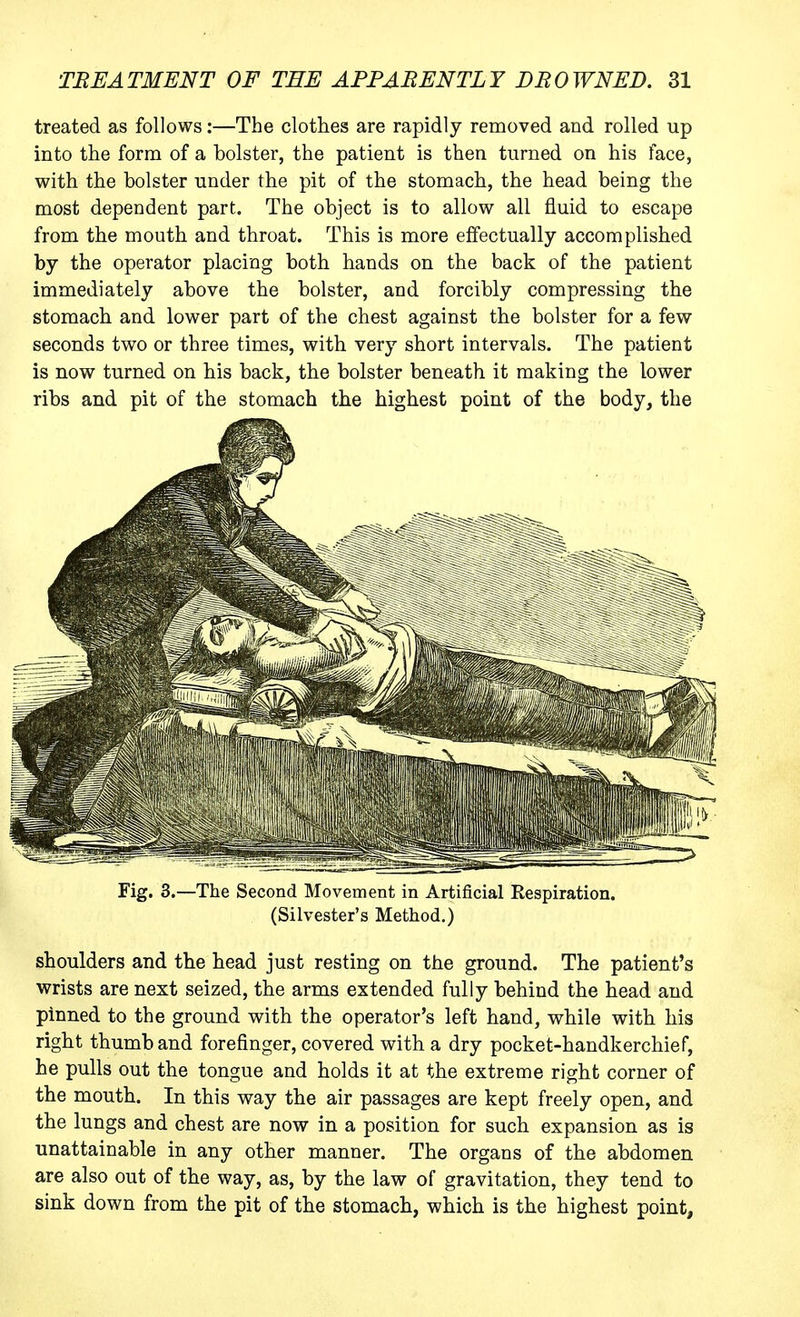 treated as follows:—The clothes are rapidly removed and rolled up into the form of a bolster, the patient is then turned on his face, with the bolster under the pit of the stomach, the head being the most dependent part. The object is to allow all fluid to escape from the mouth and throat. This is more effectually accomplished by the operator placing both hands on the back of the patient immediately above the bolster, and forcibly compressing the stomach and lower part of the chest against the bolster for a few seconds two or three times, with very short intervals. The patient is now turned on his back, the bolster beneath it making the lower ribs and pit of the stomach the highest point of the body, the Fig. 3.—The Second Movement in Artificial Respiration. (Silvester's Method.) shoulders and the head just resting on the ground. The patient's wrists are next seized, the arms extended fully behind the head and pinned to the ground with the operator's left hand, while with his right thumb and forefinger, covered with a dry pocket-handkerchief, he pulls out the tongue and holds it at the extreme right corner of the mouth. In this way the air passages are kept freely open, and the lungs and chest are now in a position for such expansion as is unattainable in any other manner. The organs of the abdomen are also out of the way, as, by the law of gravitation, they tend to sink down from the pit of the stomach, which is the highest point.