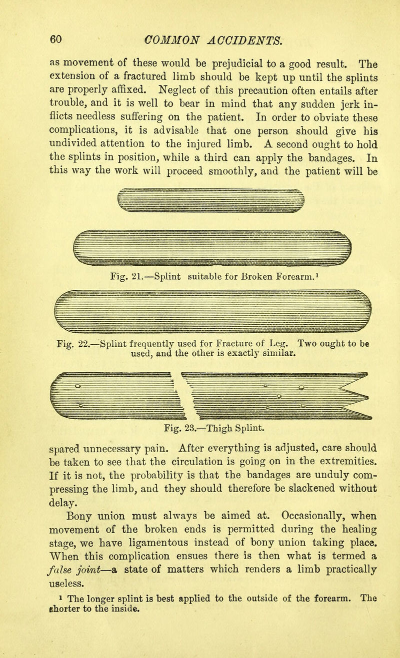 as movement of these would be prejudicial to a good result. The extension of a fractured limb should be kept up until the splints are properly affixed. Neglect of this precaution often entails after trouble, and it is well to bear in mind that any sudden jerk in- flicts needless suffering on the patient. In order to obviate these complications, it is advisable that one person should give his undivided attention to the injured limb. A second ought to hold the splints in position, while a third can apply the bandages. In this way the work will proceed smoothly, and the patient will be Fig. 21.—Splint suitable for Broken Forearm, i Fig. 22.—Splint frequently used for Fracture of Leg. Two ought to be used, and the other is exactly similar. Fig. 23.—Thigh Splint. spared unnecessary pain. After everything is adjusted, care should be taken to see that the circulation is going on in the extremities. If it is not, the probability is that the bandages are unduly com- pressing the limb, and they should therefore be slackened without delay. Bony union must always be aimed at. Occasionally, when movement of the broken ends is permitted during the healing stage, we have ligamentous instead of bony union taking place. When this complication ensues there is then what is termed a false joint—a state of matters which renders a limb practically useless. 1 The longer splint is best applied to the outside of the forearm. The shorter to the inside.