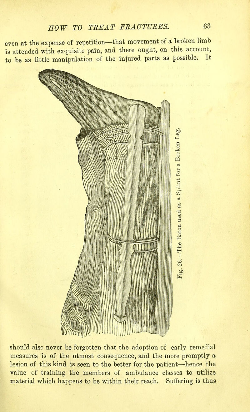 even at the expense of repetition—that movement of a broken limb is attended with exquisite pain, and there ought, on this account, to be as little manipulation of the injured parts as possible. It should also never be forgotten that the adoption of early remedial measures is of the utmost consequence, and the more promptly a lesion of this kind is seen to the better for the patient—hence the value of training the members of ambulance classes to utilize material which happens to be within their reach. Suffering is thus