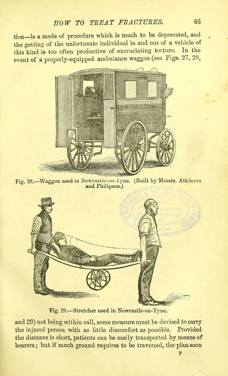 tion is a mode of procedure which is much to be deprecated, and the getting of the unfortunate individual in and out of a vehicle of this kind is too often productive of excruciating torture. In the event of a properly-equipped ambulance waggon (see Figs. 27, 28, Fig. 28.—Waggon used in Newcastle-oa-i'yne. (Built by Messrs. Atkinson and Philipson.) Fig. 29.—Stretcher used in !N'ewcastle-on-Tyne. and 29) not being within call, some measure must be devised to carry the injured person with as little discomfort as possible. Provided the distance is short, patients can be easily transported by means of bearers; but if much ground requires to be traversed, the plan soon F