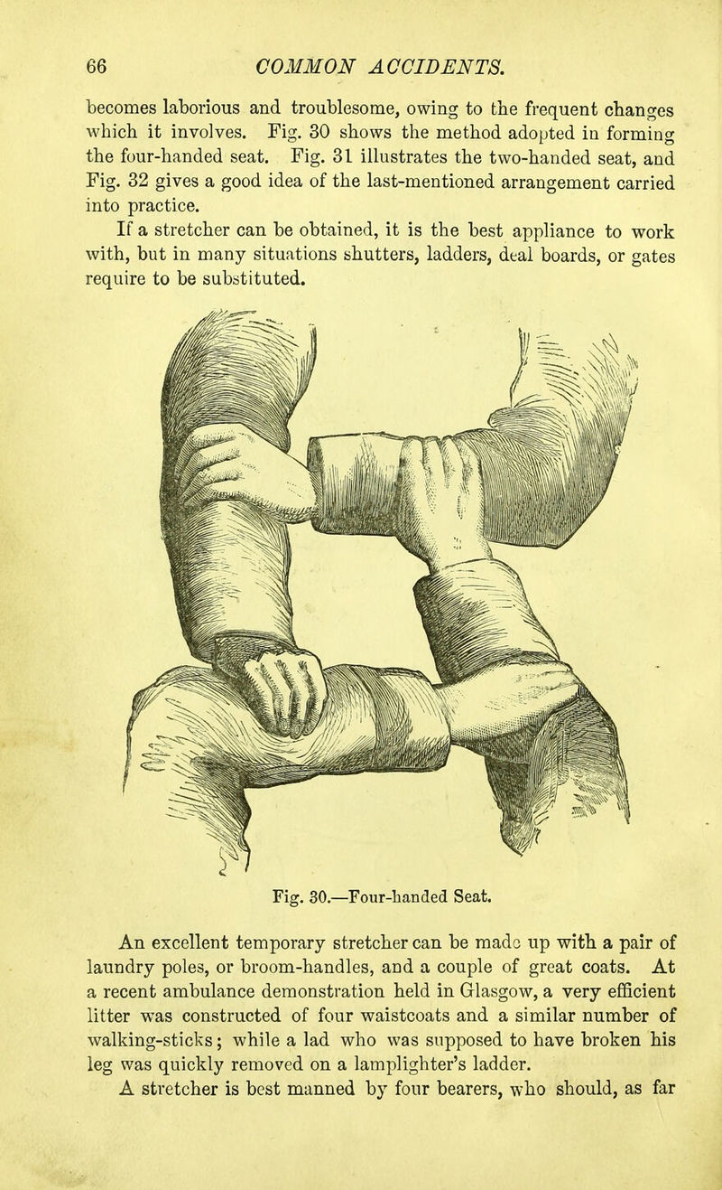 becomes laborious and troublesome, owing to the frequent changes which it involves. Fig. 30 shows the method adopted in forming the four-handed seat. Fig. 31 illustrates the two-handed seat, and Fig. 32 gives a good idea of the last-mentioned arrangement carried into practice. If a stretcher can be obtained, it is the best appliance to work with, but in many situations shutters, ladders, deal boards, or gates require to be substituted. Fig. 30.—Four-handed Seat. An excellent temporary stretcher can be mado up with a pair of laundry poles, or broom-handles, and a couple of great coats. At a recent ambulance demonstration held in Glasgow, a very efficient litter was constructed of four waistcoats and a similar number of walking-sticks; while a lad who was supposed to have broken his leg was quickly removed on a lamplighter's ladder. A stretcher is best manned by four bearers, who should, as far