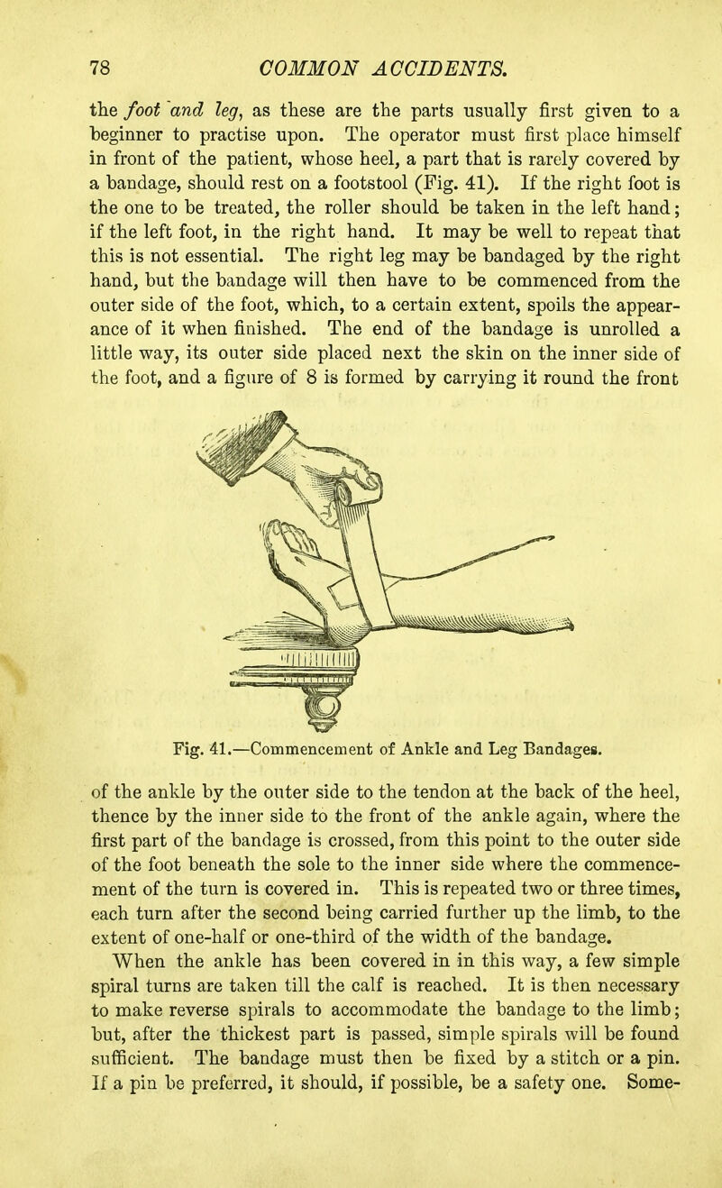 tlie foot and leg, as tliese are the parts usually first given to a beginner to practise upon. The operator must first place himself in front of the patient, whose heel, a part that is rarely covered by a bandage, should rest on a footstool (Fig. 41). If the right foot is the one to be treated, the roller should be taken in the left hand; if the left foot, in the right hand. It may be well to repeat that this is not essential. The right leg may be bandaged by the right hand, but the bandage will then have to be commenced from the outer side of the foot, which, to a certain extent, spoils the appear- ance of it when finished. The end of the bandage is unrolled a little way, its outer side placed next the skin on the inner side of the foot, and a figure of 8 is formed by carrying it round the front Fig. 41.—Commencement of Ankle and Leg Bandages. of the ankle by the outer side to the tendon at the back of the heel, thence by the inner side to the front of the ankle again, where the first part of the bandage is crossed, from this point to the outer side of the foot beneath the sole to the inner side where the commence- ment of the turn is covered in. This is repeated two or three times, each turn after the second being carried further up the limb, to the extent of one-half or one-third of the width of the bandage. When the ankle has been covered in in this way, a few simple spiral turns are taken till the calf is reached. It is then necessary to make reverse spirals to accommodate the bandage to the limb; but, after the thickest part is passed, simple spirals will be found sufficient. The bandage must then be fixed by a stitch or a pin. If a pin be preferred, it should, if possible, be a safety one. Some-