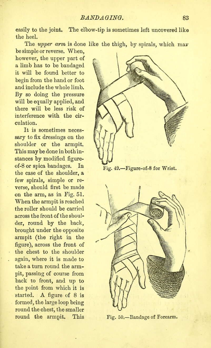 Fig. 49.—Figure-of-8 for Wrist. easily to the joint. The elbow-tip is sometimes left uncovered like the heel. The upper arm is done like the thigh, by spirals, which may be simple or reverse. When, however, the upper part of a limb has to be bandaged it will be found better to begin from the hand or foot and include the whole limb. By so doing the pressure will be equally applied, and there will be less risk of interference with the cir- culation. It is sometimes neces- sary to fix dressings on the shoulder or the armpit. This maybe done in both in- stances by modified figure- of-8 or spica bandages. In the case of the shoulder, a few spirals, simple or re- verse, should first be made on the arm, as in Fig. 51. When the armpit is reached the roller should be carried across the front of the shoul- der, round by the back, brought under the opposite armpit (the right in the figure), across the front of the chest to the shoulder again, where it is made to take a turn round the arm- pit, passing of course from back to front, and up to the point from which it is started. A figure of 8 is formed, the large loop being round the chest, the smaller round the armpit. This Fig. 50.—Bandage of Forearm.