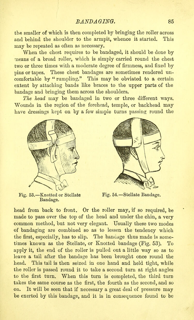 the smaller of which is then completed by bringing the roller across and behind the shoulder to the armpit, whence it started. This may be repeated as often as necessary. When the chest requires to be bandaged, it should be done by means of a broad roller, which is simply carried round the chest two or three times with a moderate degree of firmness, and fixed by pins or tapes. These chest bandages are sometimes rendered un- comfortable by  rumpling. This may be obviated to a certain extent by attaching bands like braces to the upper parts of the bandage and bringing them across the shoulders. The head may be bandaged in two or three different ways. Wounds in the region of the forehead, temple, or backhead may have dressings kept on by a few simple turns passing round the head from back to front. Or the roller may, if so required, be made to pass over the top of the head and under the chin, a very common method, but not very elegant. Usually these two modes of bandaging are combined so as to lessen the tendency which the first, especially, has to slip. The bandage thus made is some- times known as the Stellate, or Knotted bandage (Fig. 53). To apply it, the end of the roller is pulled out a little way so as to leave a tail after the bandage has been brought once round the head. This tail is then seized in one hand and held tight, while the roller is passed round it to take a second turn at right angles to the first turn. When this turn is completed, the third turn takes the same course as the first, the fourth as the second, and so on. It will be seen that if necessary a great deal of pressure may be exerted by this bandage, and it is in consequence found to be Fig. 53.—Knotted or Stellate Bandage. Fig. 54.—Stellate Bandage.