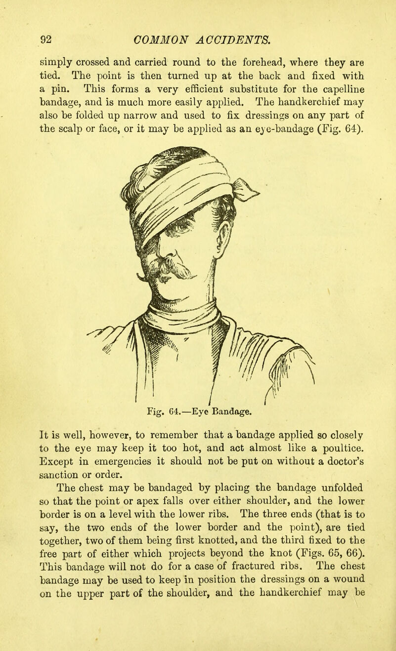 simply crossed and carried round to the forehead, where they are tied. The point is then turned up at the back and fixed with a pin. This forms a very efficient substitute for the capelline bandage, and is much more easily applied. The handkerchief may also be folded up narrow and used to fix dressings on any part of the scalp or face, or it may be applied as an e-bandage (Fig. 64). Fig. C4.—Eye Bandage. It is well, however, to remember that a bandage applied so closely to the eye may keep it too hot, and act almost like a poultice. Except in emergencies it should not be put on without a doctor's sanction or order. The chest may be bandaged by placing the bandage unfolded so that the point or apex falls over either shoulder, and the lower border is on a level with the lower ribs. The three ends (that is to say, the two ends of the lower border and the point), are tied together, two of them being first knotted, and the third fixed to the free part of either which projects beyond the knot (Figs. 65, 66). This bandage will not do for a case of fractured ribs. The chest bandage may be used to keep in position the dressings on a wound on the upper part of the shoulder, and the handkerchief may be