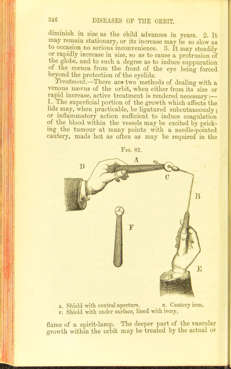 dimmisli in size as the child advances in years. 2. It may remain stationary, or its increase may be so slow as to occasion no serious inconvenience. 3. It may steadily or rapidly increase in size, so as to cause a protrusion of the globe, and to such a degree as to induce suppuration of the cornea from the front of the eye being forced beyond the protection of the eyelids. Treatment.—There are two methods of dealing with a venous ntevus of the orbit, when either from its size or rapid increase, active treatment is rendered necessary:— 1. The supei-ficial portion of the growth which affects the lids may, when practicable, be ligatured subcutaneously ; or inflammatory action sufficient to induce coagulation of the blood within the vessels may be excited by prick- ing the tumour at many points with a needle-poiated cautery, made hot as often as may be required ia the Fig. 82. A. Shield with central aperture. b. Cautery iron. F. Shield with under surface, lined with ivory. flame of a spirit-lamp. The deeper part of the vascular growth within the orbit may be treated by the actual or