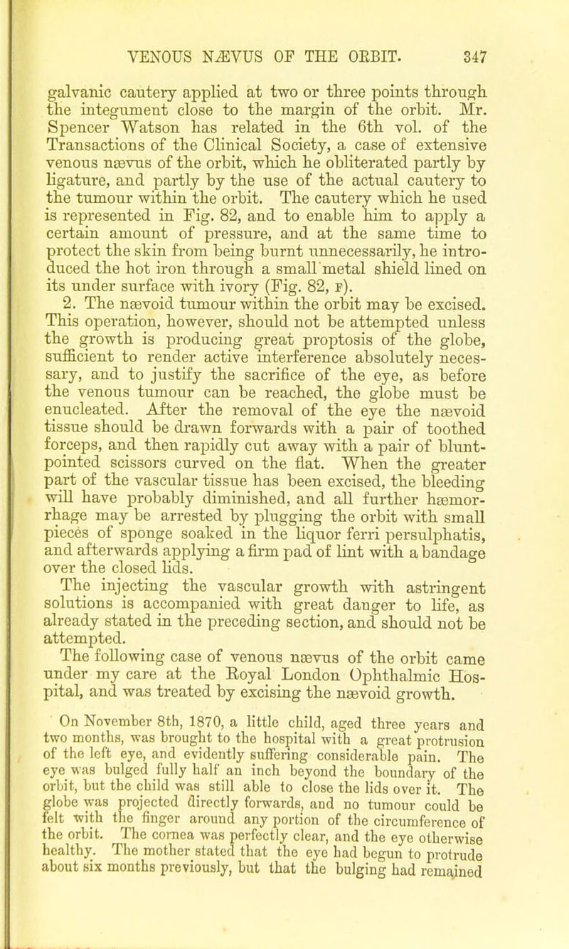 galvanic cautery applied at two or three points through, the integument close to the margin of the orbit. Mr. Spencer Watson has related in the 6th vol. of the Transactions of the Clinical Society, a case of extensive venous n^vus of the orbit, vyhich he obliterated partly by ligature, and partly by the use of the actual cautery to the tumour within the orbit. The cautery which he used is represented in Fig. 82, and to enable him to apply a certain amount of pressure, and at the same time to protect the skin from being burnt unnecessarily, he intro- duced the hot iron through a small'metal shield lined on its under surface with ivory (Fig. 82, f). 2. The nsevoid tumour within the orbit may be excised. This operation, however, should not be attempted unless the growth is producing great proptosis of the globe, sufficient to render active interference absolutely neces- sary, and to justify the sacrifice of the eye, as before the venous tumour can be reached, the globe must be enucleated. Aiter the removal of the eye the ngevoid tissue should be drawn forwards with a paii- of toothed forceps, and then rapidly cut away with a pair of blunt- pointed scissors curved on the flat. When the greater part of the vascular tissue has been excised, the bleeding will have probably diminished, and all further hgemor- rhage may be arrested by plugging the orbit with small pieces of sponge soaked in the liquor ferri persulphatis, and afterwards applying a firm pad of lint with a bandage over the closed Hds. The injecting the vascular growth with astringent solutions is accompanied with great danger to life, as already stated in the preceding section, and should not be attempted. The following case of venous nsevus of the orbit came under my care at the Royal London Ophthalmic Hos- pital, and was treated by excising the naevoid growth. On November 8th, 1870, a little child, aged three years and two months, was brought to the hospital with a great protrusion of the left eye, and evidently suffering considerable pain. The eye was bulged fully half an inch beyond the boundary of the orbit, but the child was still able to close the lids over it. The globe was projected directly forwards, and no tumour could be feh with the finger around any portion of the circumference of the orbit. The cornea was perfectly clear, and the eye otherwise healthy. The mother stated that the eye had begun to protrude about six months previously, but that the bulging had remained