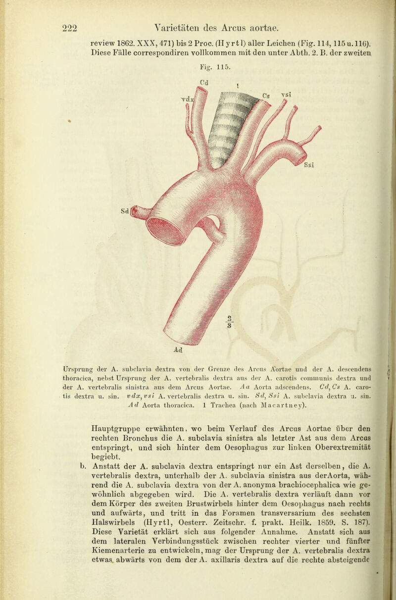 2 Ad Ursprung der A. subclavia dextra von der Grenze des Arcus A^'ortae und der A. descendens thoracica, nebst Ursprung der A. vertebralis dextra aus der A. carotis communis dextra und der A. vertebralis sinistra aus dem Arcus Aortae. Aa Aorta adscendens. Cd^Cs A. caro- tis dextra u. sin. vdx^vsi A. vertebralis dextra u. sin. Sd^Ssi A. subclavia dextra u. sin. Ad Aorta thoracica. 1 Trachea (nach Macartney). HauptgTuppe erwähnten, wo beim Verlauf des Arcus Aortae über den rechten Bronchus die A. subclavia sinistra als letzter Ast aus dem Arcus entspringt, und sich hinter dem Oesophagus zur linken Oberextremität begiebt. b. Anstatt der A. subclavia dextra entspringt nur ein Ast derselben, die A. vertebralis dextra, unterhalb der A. subclavia sinistra aus derAorta, wäh- rend die A. subclavia dextra von der A. anonyma brachiocephalica wie ge- wöhnlich abgegeben wird. Die A. vertebralis dextra verläuft dann vor dem Körper des zweiten Brustwirbels hinter dem Oesophagus nach rechts und aufwärts, und tritt in das Foramen transversarium des sechsten Halswirbels (Hyrtl, Oesterr. Zeitschr. f. prakt. Heilk. 1859. S. 187). Diese Varietät erklärt sich aus folgender Annahme. Anstatt sich aus dem lateralen Verbindungsstück zwischen rechter vierter und fünfter Kiemenarterie zu entwickeln, mag der Ursprung der A. vertebralis dextra etwas abwärts von dem der A. axillaris dextra auf die rechte absteigende