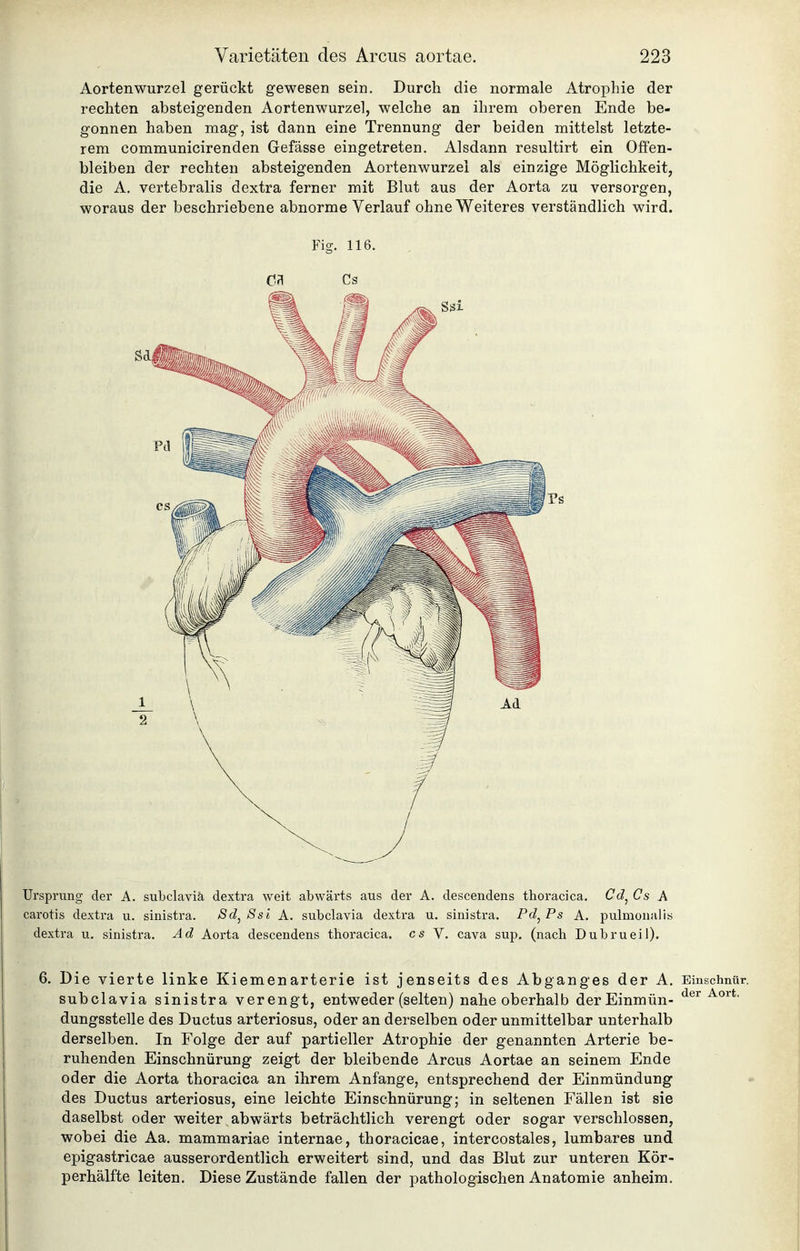 Aorten Wurzel gerückt gewesen sein. Durch die normale Atrophie der rechten absteigenden Aortenwurzel, welche an ihrem oberen Ende be- gonnen haben mag, ist dann eine Trennung der beiden mittelst letzte- rem communicirenden Gefässe eingetreten. Alsdann resultirt ein Offen- bleiben der rechten absteigenden Aortenwurzei als einzige Möglichkeit, die A. vertebralis dextra ferner mit Blut aus der Aorta zu versorgen, woraus der beschriebene abnorme Verlauf ohne Weiteres verständlich wird. Fig. 116. Ursprung der A. subclavia dextra weit abwärts aus der A. descendens thoracica. Cd^Cs A carotis dextra u. sinistra. 8d^ Ssi A. subclavia dextra u. sinistra. Pd^ Ps A. pulmonal]s dextra u. sinistra. Ad Aorta descendens thoracica, es Y. cava sup. (nach Dubrueil). 6. Die vierte linke Kiemenarterie ist jenseits des Abganges der A. Einschnür. subclavia sinistra verengt, entweder (selten) nahe oberhalb derEinmün- dungsstelle des Ductus arteriosus, oder an derselben oder unmittelbar unterhalb derselben. In Folge der auf partieller Atrophie der genannten Arterie be- ruhenden Einschnürung zeigt der bleibende Arcus Aortae an seinem Ende oder die Aorta thoracica an ihrem Anfange, entsprechend der Einmündung des Ductus arteriosus, eine leichte Einschnürung; in seltenen Fällen ist sie daselbst oder weiter abwärts beträchtlich verengt oder sogar verschlossen, wobei die Aa. mammariae internae, thoracicae, intercostales, lumbares und epigastricae ausserordentlich erweitert sind, und das Blut zur unteren Kör- perhälfte leiten. Diese Zustände fallen der pathologischen Anatomie anheim.