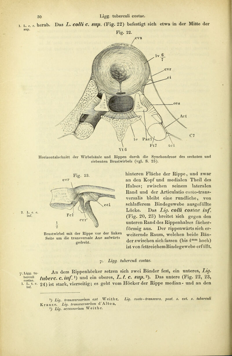 1. L. c. c. herab. Das L. colli C. sup. . CFig. 22) befestigt sich etwa in der Mitte der Fig. 22. Tt6 Horizontalschnitt der Wirbelsäule und Rippen durch die Synchondrose des sechsten und siebenten Brustwirbels (vgl. S. 25). Fii 23. L. c iuf. Brustwirbel mit der Rippe vor der linken Seite um die transversale Axe aufwärts gedreht. hinteren Fläche der Rippe, und zwar an den Kopf und medialen Theil des Halses; zwischen seinem lateralen Rand und der Articulatio costo-trans- versalis bleibt eine rundliche, von schlafferem Bindegewebe ausgefüllte Lücke. Das Lig. colli costae inf. (Fig. 20, 23) breitet sich gegen den unteren Rand des Rippenhalses fächer- förmig aus. Der rippenwärts sich er- weiternde Raum, welchen beide Bän- der zwischen sich fassen (bis 4™™ hoch) ist von fettreichem Bindegewebe erfüllt. y. Ligg. tuberculi costae. /.Ligg. tu- An dem Rippenhöcker setzen sich zwei Bänder fest, ein unteres, Lig. bercuii tuhevc. C.inf.^) und ein oberes, L,t. C. sup.^). Das untere (Fig. 22, 23, 1. L. t.'c. 24Mst stark, vierseitig; es geht vom Höcker der Rippe median- und an den ^) Lig. transversarium ext Weitbr. Krause. Lig. transversarium d' A11 o n. ^) Lig. accessorimn Weitbr. Lig. costo - transvers. post. s. ext. s. tuberculi