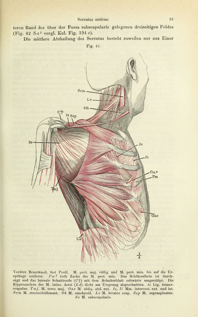 teren Rand des über der Fossa siibscapularis gelegenen dreiseitigen Feldes (Fig. 42 aS«! vergl. Knl. Fig. 194 5). Die mittlere Abtheilung des Serratus besteht zuweilen nur aus Einer Fig. 41. Vordere Brustwand, fast Profil. M. pect. maj. völlig und M. pect. min. bis auf die Ur- sprünge entfernt. Pm * tiefe Zacke des M. pect. min. Das Schlüsselbein ist durch- sägt und das laterale Schnittende (Cf) mit dem Schulterblatt seitwärts umgestülpt. Die Rippenzacken des M. latiss. dorsi {Ld) dicht am Ursprung abgeschnitten. ^5 Lig. transv. scapulae. Tmj. M. teres maj. Oae M. obliq. abd. ext. le, Ii Mm. intercost. ext, und int. Sem M. sternocleidomast. Oh M. omohyoid. Ls M. levator scap. 8sp M. supraspinatus. 8s M. subscapularis.