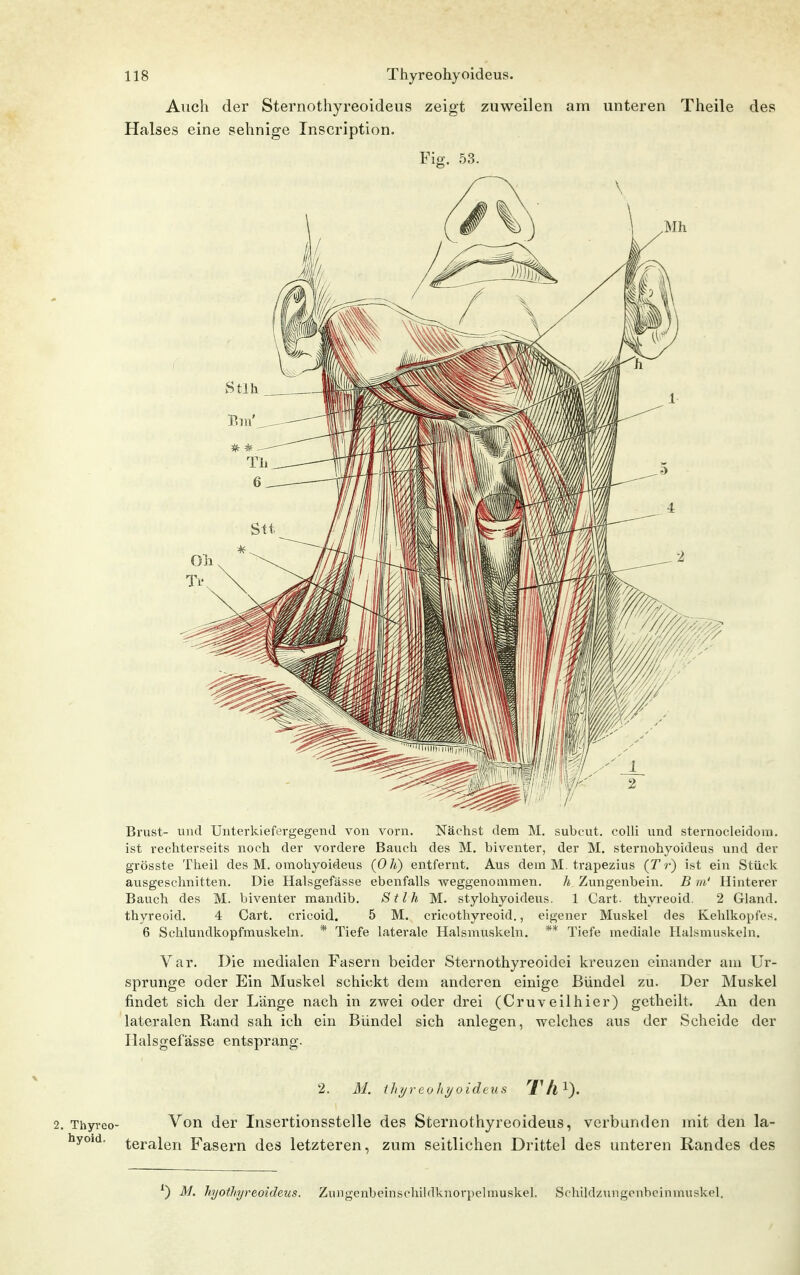 Auch der Sternothyreoideus zeigt zuweilen am unteren Theile des Halses eine sehnige Inscription. Fig. 53. Brust- und Unterkiefergegend von vorn. Nächst dem M. subcut. colli und sternocleidom, ist rechterseits noch der vordere Bauch des M. biventer, der M. sternohyoideus und der grösste Theil des M. omohyoideus (Oh) entfernt. Aus dem M. trapezius (T r) ist ein Stück ausgeschnitten. Die Halsgefässe ebenfalls weggenommen. h Zungenbein. B m' Hinterer Bauch des M. biventer mandib. Stlh M. stylohyoideus. 1 Cart. thyreoid. 2 Gland. thyreoid, 4 Cart. cricoid. 5 M. cricothyreoid., eigener Muskel des Kehlkopfes. 6 Schlundkopfmuskeln. * Tiefe laterale Halsmuskeln. ** Tiefe mediale Halsmuskeln. Var. Die medialen Fasern beider Sternothyreoidei lu'euzcn einander am Ur- sprünge oder Ein Muskel schickt dem anderen einige Bündel zu. Der Muskel findet sich der Länge nach in zwei oder drei (Cruveilhier) getheilt. An den lateralen Rand sah ich ein Bündel sich anlegen, welches aus der Scheide der Halsgefässe entsprang. 2. M. ilii/reohyoidexLS Y'A^). 2. Thyi-eo- Von der Insertionsstelle des Sternothyreoideus, verbunden mit den la- byoid. teralen Fasern des letzteren, zum seitlichen Drittel des unteren Randes des ) M, hyothyreoideus. Zungcnbeinschildknorpelmuskel. Schildzungonbcinmuskel.