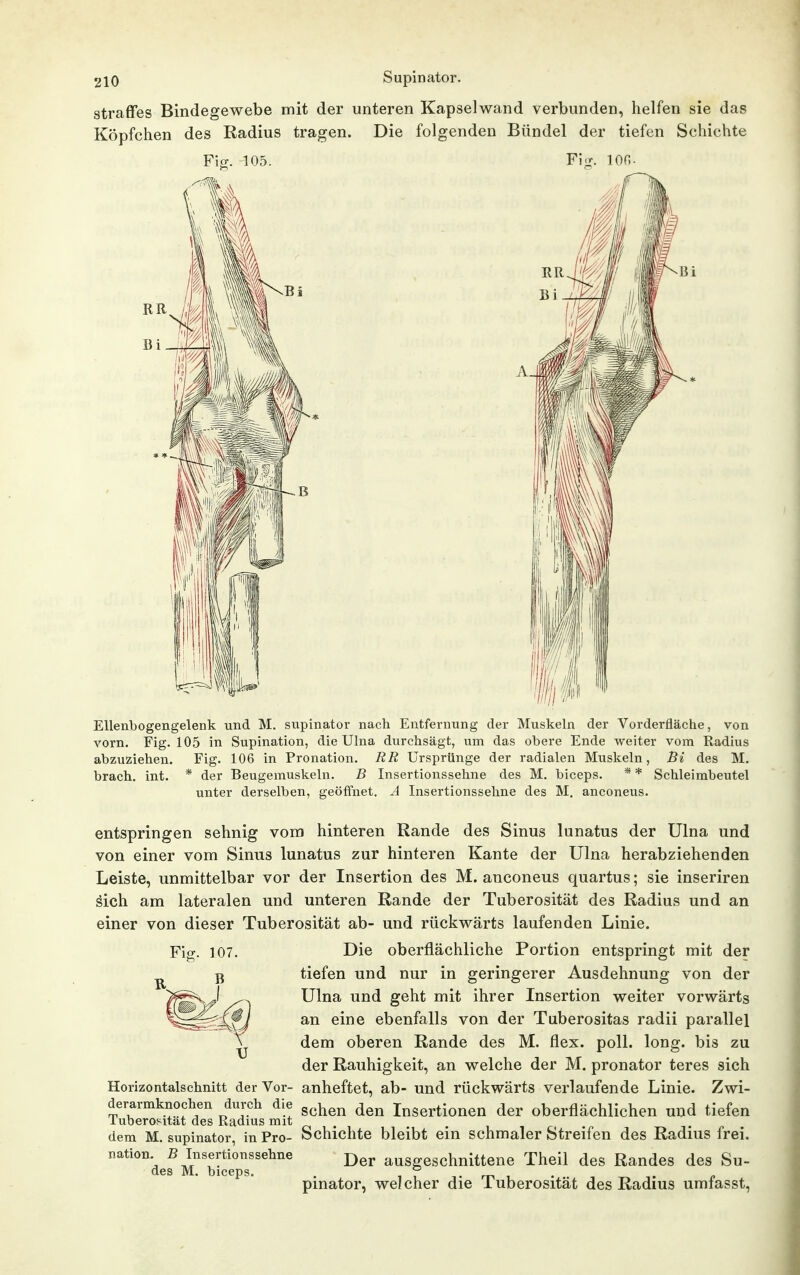 straffes Bindegewebe mit der unteren Kapselwand verbunden, helfen sie das Köpfchen des Radius tragen. Die folgenden Bündel der tiefen Schichte Ellenbogengelenk und M. supinator nach Entfernung der Muskeln der Vorderfläche, von vorn. Fig. 105 in Supination, die Ulna durchsägt, um das obere Ende weiter vom Radius abzuziehen. Fig. 106 in Pronation. RR Ursprünge der radialen Muskeln, Bi des M. brach, int. * der Beugemuskeln. B Insertionssehne des M, biceps. * * Schleimbeutel unter derselben, geöffnet. A Insertionssehne des M. anconeus. entspringen sehnig vom hinteren Rande des Sinus lunatus der Ulna und von einer vom Sinus lunatus zur hinteren Kante der Ulna herabziehenden Leiste, unmittelbar vor der Insertion des M. anconeus quartus; sie inseriren äich am lateralen und unteren Rande der Tuberosität des Radius und an einer von dieser Tuberosität ab- und rückwärts laufenden Linie. Die oberflächliche Portion entspringt mit der tiefen und nur in geringerer Ausdehnung von der Ulna und geht mit ihrer Insertion weiter vorwärts an eine ebenfalls von der Tuberositas radii parallel dem oberen Rande des M. flex. poll. long, bis zu der Rauhigkeit, an welche der M. pronator teres sich Horizontalschnitt der Vor- anheftet, ab- und rückwärts verlaufende Linie. Zwi- derarmknochen durch die ^^^^^^ Insertionen der oberflächlichen und tiefen luberoMtat des Radius mit ^ , . . i , r t n dem M. supinator, in Pro- Schichte bleibt ein schmaler Streifen des Radius frei. Der ausgeschnittene Theil des Randes des Su- pinator, welcher die Tuberosität des Radius umfasst. nation. B Insertionssehne des M. biceps.
