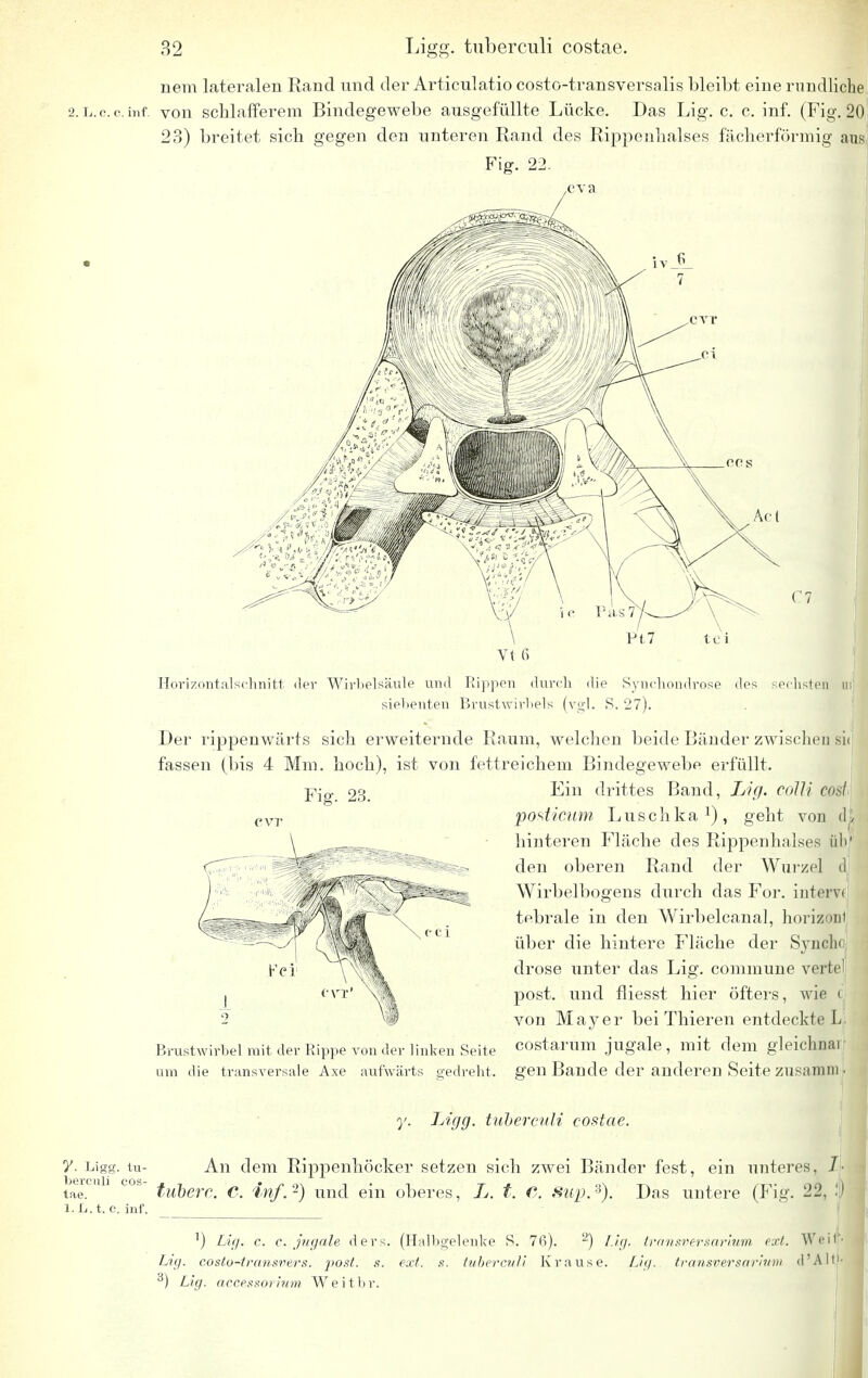 nem lateralen Rand und der Articulatio costo-transversalis bleibt eine rundliche 2.L.c.c.inf. von schlafferem Bindegewebe ausgefüllte Lücke. Das Lig. c. c. inf. (Fig. 20 23) breitet sich gegen den unteren Rand des Rippenhalses fächerförmig aus, Fig. 22. ,eva Horizontalschnitt iler Wirbelsäule und Rippen durch die Synchondrose des sechste« siebenten Brustwirbels (vgl. S. '27). Der rippenwärts sich erweiternde Raum, welchen beide Bänder zwischen fassen (bis 4 Mm. hoch), ist von fettreichem Bindegewebe erfüllt. Fig. 23. Fei Brustwirbel mit der Rippe A'on der linken Seite um die transversale Axe aufwärts gedreht. Ein drittes Band, Lig. colli co$l posticum Luschka1), geht von d] hinteren Fläche des Rippenhalses übt den oberen Rand der Wurzel d Wirbelbogens durch das For. intervi tebrale in den Wirbelcanal, horizonl über die hintere Fläche der Synchc drose unter das Lig. commune vertel post. und fliesst hier öfters, wie i von Mayer bei Thieren entdeckte Li costarum jugale, mit dem gleichnai gen Bande der anderen Seite zusamml y. Ligg. tuberculi costae. An dem Rippenhöcker setzen sich zwei Bänder fest, ein unteres, Ii y. Ligg. tu- tae.CU1 C0S tuberc. C. inf.'2) und ein oberes, L. t. C. Hup.2). Das untere (Fig. 21, l.L.t. e. inf. 1) Lig. c. c. jugale ders. (Halbgelenke S. 76). 2) Lig. transversarium ext. Weif Lig. costo-transvers. post. s. ext. s. tuberc?//! Krause. Lig. transversarium d'Allf 3) Lig. accessorium Weitbr.