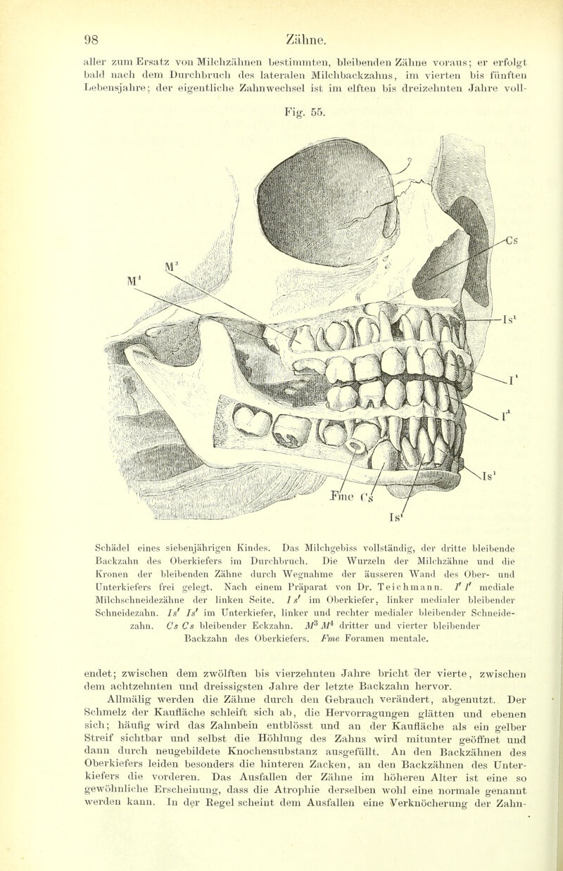 aller zum Ersatz von Milchzähnen bestimmten, bleibenden Zähne voraus; er erfolgt bald nach dem Durchbruch des lateralen Milchbackzahns, im vierten bis fünften Lebensjahre; der eigentliche Zahnwechsel ist im elften bis dreizehnten Jahre voll- Fig. 55. Schädel eines siebenjährigen Kindes. Das Milchgebiss vollständig, der dritte bleibende Backzahn des Oberkiefers im Durchbruch. Die Wurzeln der Milchzähne und die Kronen der bleibenden Zähne durch Wegnahme der äusseren Wand des Ober- und Unterkiefers frei gelegt. Nach einem Präparat von Dr. Teichmann. / / mediale Milchschneidezähne der linken Seite. 1 s' im Oberkiefer, linker medialer bleibender Schneidezahn. Isr Is' im Unterkiefer, linker und rechter medialer bleibender Schneide- zahn. Cs Cs bleibender Eckzahn. M3 dritter und vierter bleibender Backzahn des Oberkiefers. Fme Foramen mentale. endet; zwischen dem zwölften bis vierzehnten Jahre bricht der vierte, zwischen dem achtzehnten und dreissigsten Jahre der letzte Backzahn hervor. Allmälig werden die Zähne durch den Gebrauch verändert, abgenutzt. Der Schmelz der Kaufläche schleift sich ab, die Hervorragungen glätten und ebenen sich; häufig wird das Zahnbein entblösst und an der Kaufläche als ein gelber Streif sichtbar und selbst die Höhlung des Zahns wird mitunter geöffnet und dann durch neugebildete Knochensubstanz ausgefüllt. An den Backzähnen des Oberkiefers leiden besonders die hinteren Zacken, an den Backzähnen des Unter- kiefers die vorderen. Das Ausfallen der Zähne im höheren Alter ist eine so gewöhnliche Erscheinung, dass die Atrophie derselben wohl eine normale genannt werden kann. In der Regel scheint dem Ausfallen eine Verknöcherung der Zahn-