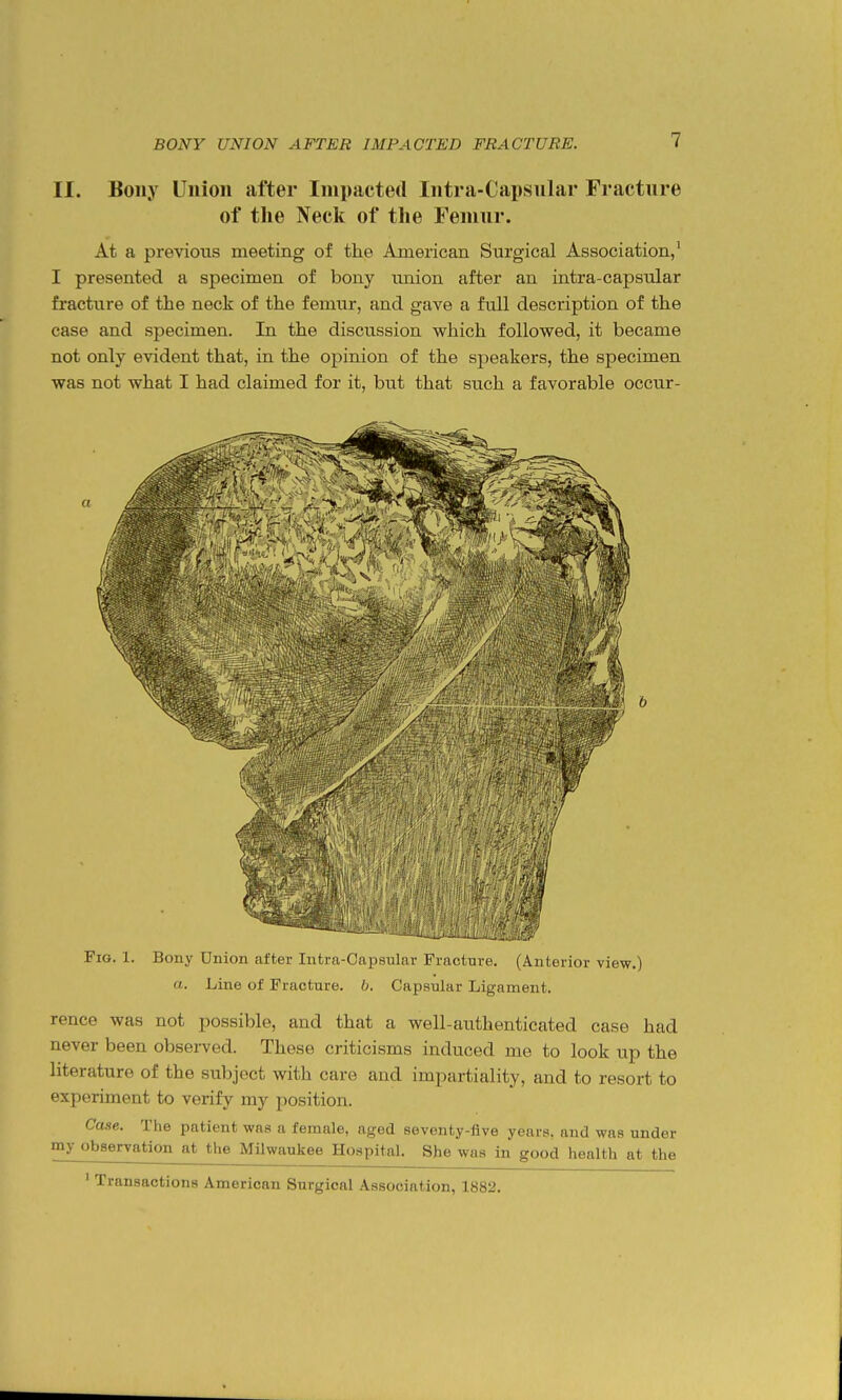 II. Bony Union after Impacted Intra-Capsular Fracture of the Neck of the Femur. At a previous meeting of the American Surgical Association,' I presented a specimen of bony union after an intra-capsular fracture of the neck of the femur, and gave a full description of the case and specimen. In the discussion which followed, it became not only evident that, in the opinion of the speakers, the specimen was not what I had claimed for it, but that such a favorable occur- Fio. 1. Bony Union after Intra-Oapsular Fiacluie. (Auterior view.) a. Line of Fracture. 6. Capsular Ligament. rence was not possible, and that a well-authenticated case had never been obsei-ved. These criticisms induced me to look up the literature of the subject with care and impartiality, and to resort to experiment to verify my position. Case. The patient was a female, aged seventy-five years, and was under my observation at the Milwaukee Hospital. She was in good health at the ' Transactions American Surgical Association, 1882.