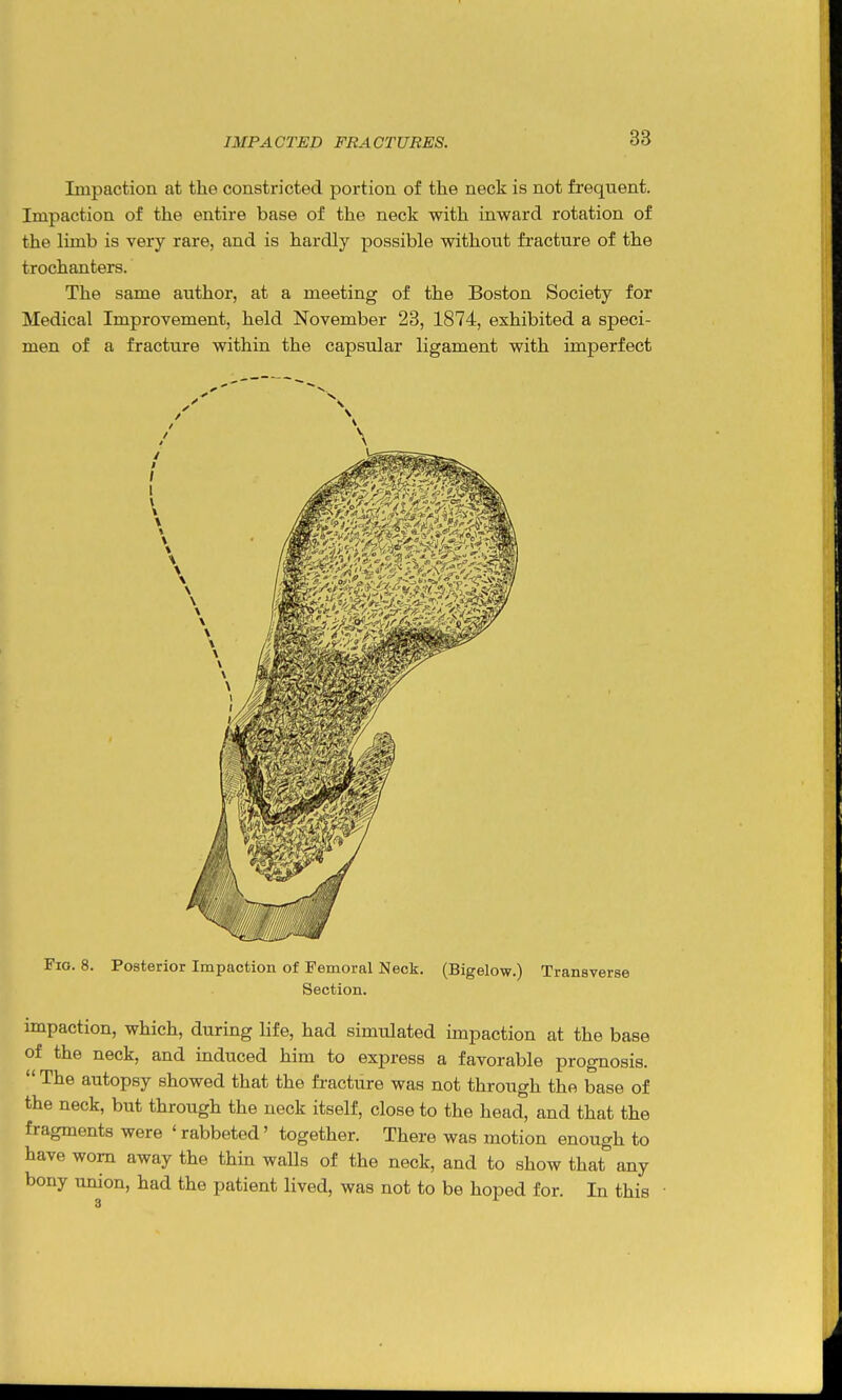 Impaction at the constricted portion of the neck is not frequent. Impaction of the entire base of the neck with inward rotation of the limb is very rare, and is hardly possible without fracture of the trochanters. The same author, at a meeting of the Boston Society for Medical Improvement, held November 23, 1874, exhibited a speci- men of a fracture within the capsular ligament with imperfect Fio. 8. Posterior Impaction of Femoral Neck. (Bigelow.) Transverse Section. impaction, which, during life, had simulated impaction at the base of the neck, and induced him to express a favorable prognosis.  The autopsy showed that the fracture was not through the base of the neck, but through the neck itself, close to the head, and that the fragments were ' rabbeted' together. There was motion enough to have worn away the thin walls of the neck, and to show that any bony union, had the patient lived, was not to be hoped for. In this •