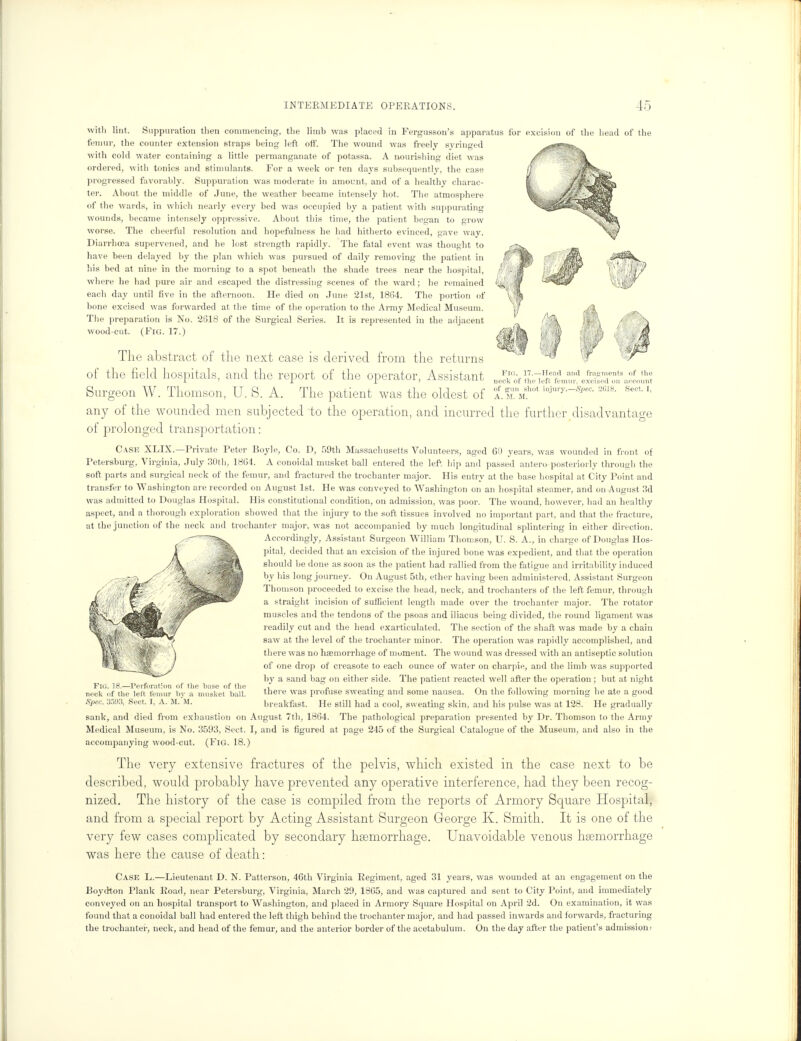 with lint. Suppuration then commencing, the limb was placed in Fergusson's apparatus for excision of the head of the femur, the counter extension straps being left off. The wound was freely syringed with cold water containing a little permanganate of potassa. A nourishing diet was ordered, with tonics and stimulants. For a week or ten days subsequently, the case progressed favorably. Suppuration was moderate in amount, and of a healthy charac- ter. About the middle of June, the weather became intensely hot. The atmosphere of the wards, in which nearly every bed was occupied by a patient with suppurating wounds, became intensely oppressive. About this time, the patient began to grow worse. The cheerful resolution and hopefulness he had hitherto evinced, gave way. Diarrhoea supervened, and he lost strength rapidly. The fatal event was thought to have been delayed by the plan which was pursued of daily removing the patient in his bed at nine in the morning to a spot beneath the shade trees near the hospital, where he had pure air and escaped the distressing scenes of the ward; he remained each day until five in the afternoon. He died on June 21st, 18(54. The portion of bone excised was forwarded at the time of the operation to the Army Medical Museum. The preparation is No. 2618 of the Surgical Series. It is represented in the adjacent wood-cut. (Fig. 17.) Flo. 17.—Head and fragments of tin' neck of the left femur, excised on account of gun shot injury.—Spec. 2u18. Sect. I, A. M. M. The abstract of the next case is derived from the returns of the field hospitals, and the report of the operator, Assistant Surgeon W. Thomson, U. S. A. The patient was the oldest of any of the wounded men subjected to the operation, and incurred the further disadvantage of prolonged transportation: Case XLIX.—Private Peter Boyle, Co. D, 59th Massachusetts Volunteers, aged 60 years, was wounded in front of Petersburg, Virginia, July 30th, 1864. A conoidal musket ball entered the left hip and passed antero-posteriorly through the soft parts and surgical neck of the femur, and fractured the trochanter major. His entry at the base hospital at City Point and transfer to Washington are recorded on August 1st. He was conveyed to Washington on an hospital steamer, and on August 3d was admitted to Douglas Hospital. His constitutional condition, on admission, was poor. The wound, however, had an healthy aspect, and a thorough exploration showed that the injury to the soft tissues involved no important part, and that the fracture, at the junction of the neck and trochanter major, was not accompanied by much longitudinal splintering in either direction. Accordingly, Assistant Surgeon William Thomson, U. S. A., in charge of Douglas Hos- pital, decided that an excision of the injured hone was expedient, and that the operation should be done as soon as the patient had rallied from the fatigue and irritability induced by his long journey. On August 5th, ether having been administered, Assistant Surgeon Thomson proceeded to excise the head, neck, and trochanters of the left femur, through a straight incision of sufficient length made over the trochanter major. The rotator muscles and the tendons of the psoas and iliacus being divided, the round ligament was readily cut and the head exarticulated. The section of the shaft was made by a chain saw at the level of the trochanter minor. The operation was rapidly accomplished, and there was no haemorrhage of mument. The wound was dressed with an antiseptic solution of one drop of creasote to each ounce of water on charpie, and the limb was supported by a sand bag on either side. The patient reacted well after the operation ; but at night there was profuse sweating and some nausea. On the following morning lie ate a good breakfast. He still had a cool, sweating skin, and his pulse was at 128. He gradually sank, and died from exhaustion on August 7th, 1864. The pathological preparation presented by Dr. Thomson to the Army Medical Museum, is No. 3593, Sect. I, and is figured at page 245 of the Surgical Catalogue of the Museum, and also in the accompanying wood-cut. (Fig. 18.) The very extensive fractures of the pelvis, which existed in the case next to be described, would probably have prevented any operative interference, had they been recog- nized. The history of the case is compiled from the reports of Armory Square Hospital, and from a special report by Acting Assistant Surgeon George K. Smith. It is one of the very few cases complicated by secondary haemorrhage. Unavoidable venous haemorrhage was here the cause of death: Case L.—Lieutenant D. N. Patterson, 46th Virginia Regiment, aged 31 years, was wounded at an engagement on the Boydton Plank Road, near Petersburg, Virginia, March 29, 1865, and was captured and sent to City Point, and immediately conveyed on an hospital transport to Washington, and placed in Armory Square Hospital on April 2d. On examination, it was found that a conoidal ball had entered the left thigh behind the trochanter major, and had passed inwards and forwards, fracturing the trochanter, neck, and head of the femur, and the anterior border of the acetabulum. On the day after the patient's admission! Fio. ] 8.—Perforation of the base of the neck of the left femur by a musket hall. Spec. 35'J3, Sect. I, A. SI. M.