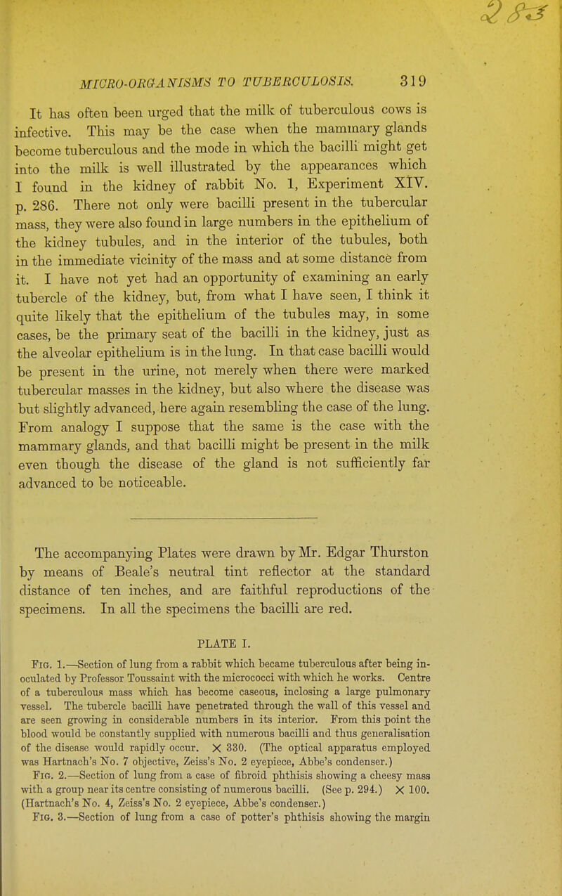 It hcas often been urged that the milk of tuberculous cows is infective. This mcay be the case when the mammary glands become tuberculous and the mode in which the bacilli might get into the milk is well illustrated by the appearances which I found in the kidney of rabbit No. 1, Experiment XlV. p. 286. There not only were bacilli present in the tubercular mass, they were also found in large numbers in the epithelium of the kidney tubules, and in the interior of the tubules, both in the immediate vicinity of the mass and at some distance from it. I have not yet had an opportunity of examining an early tubercle of the kidney, but, from what I have seen, I think it quite likely that the epithelium of the tubules may, in some cases, be the primary seat of the bacilli in the kidney, just as the alveolar epithelium is in the lung. In that case bacilli would be present in the urine, not merely when there were marked tubercular masses in the kidney, but also where the disease was but slightly advanced, here again resembling the case of the lung. From analogy I suppose that the same is the case with the mammary glands, and that bacilli might be present in the milk even though the disease of the gland is not sufficiently far advanced to be noticeable. The accompanying Plates were drawn by Mr. Edgar Thurston by means of Beale's neutral tint reflector at the standard distance of ten inches, and are faithful reproductions of the specimens. In all the specimens the bacilli are red. PLATE I. Fig. 1.—Section of lung from a rabMt which became tuberculous after being in- oculated by Professor Toussaint with the micrococci with which he works. Centre of a tuberculous mass which has become caseous, inclosing a large pulmonary vessel. The tubercle bacilli have penetrated through the wall of this vessel and are seen growing ia considerable numbers in its interior. From this point the blood would be constantly supplied with numerous bacilli and thus generalisation of the disease would rapidly occur. X 330. (The optical apparatus employed was Hartnach's No. 7 objective, Zeiss's No. 2 eyepiece. Abbe's condenser.) Fig. 2.—Section of lung from a case of fibroid phthisis showing a cheesy mass with a group near its centre consisting of numerous bacilli. (See p. 294.) X 100. (Hartnach's No. 4, Zeiss's No. 2 eyepiece, Abbe's condenser.) Fig. 3.—Section of lung from a case of potter's phthisis showing the margin