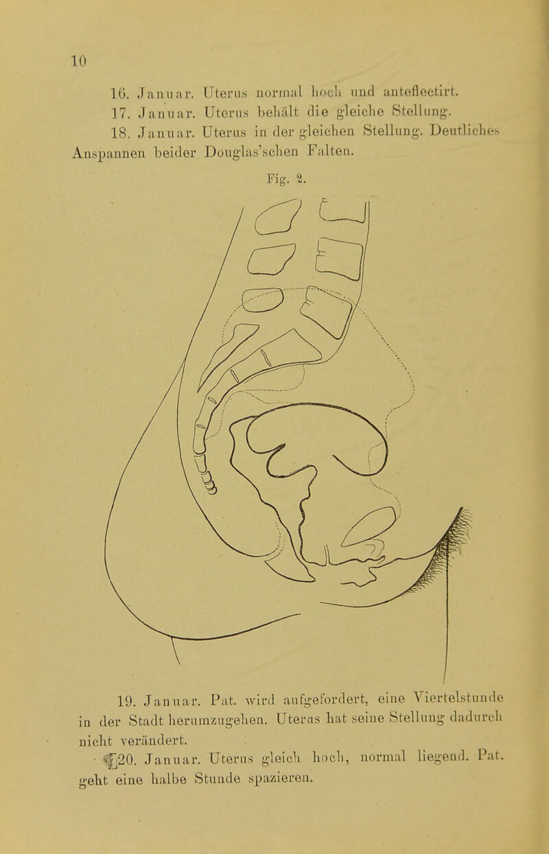 16. Januar. Uterus normal hoch und auteflectirt. 17. Januar. Uterus behält die gleiche »Stellung. 18. Januar. Uterus in der gleichen Stellung. Deutliches Anspannen beider DougWschen Falten. Fig. 2. \ / 19. Januar. Pat. wird aufgefordert, eine Viertelstunde in der Stadt herumzugehen. Uterus hat seine Stellung dadurch nicht verändert. fj20. Januar. Uterus gleich hoch, normal liegend. Pat. geht eine halbe Stunde spazieren.