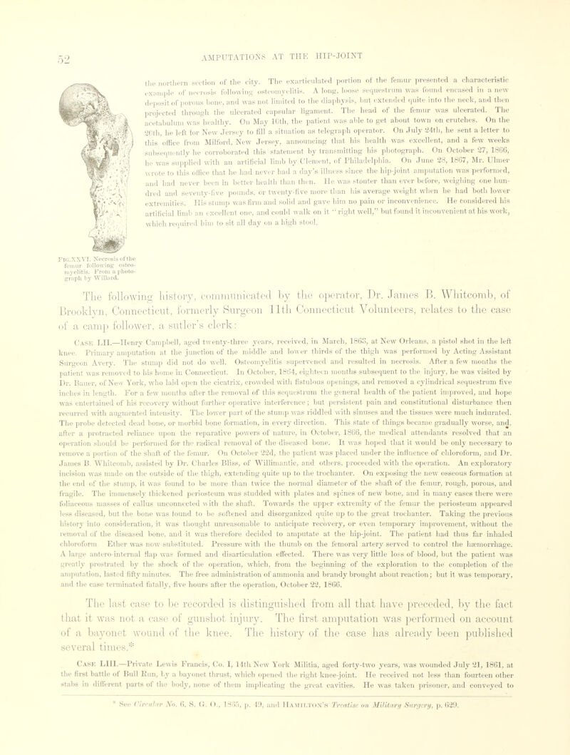 the northern section of the city. The exarticulated portion of the femur presented a characteristic example of necrosis following osteomyelitis. A long, loose sequestrum was round encased in a new depositor porous hone, and was not limited to the diaphysis, but extended quite into the neck, and then projected through the ulcerated capsular ligament. The head of the femur was ulcerated. The acetabulum was healthy. On May 10th, the patient was able to get about town on crutches. On the 20th he left for New Jersey to fill a situation as telegraph operator. On July :24th, he sent a letter to this office from Milford, New Jersey, announcing that his health was excellent, and a few weeks subsequently he corroborated this statement by transmitting his photograph. On October 27, 1866, he was supplied with an artificial limb by Clement, of Philadelphia. On June 28, 1867, Mr. Ulmer w rote to this office that he had never had a day's illness since the hip-joint amputation was performed, and had never been in better health than then. He was stouter than ever before, weighing one hun- dred and seventy-live pounds, or twenty-five more than his average weight when he had both lower extremities. His stump was firm and solid and gave him no pain or inconvenience. He considered his artificial limb an excellent one, and could walk on it  right well, but found it inconvenient at his work, which required him to sit all clay on a high stool, FIG.XXVI. Necrosis of the femur following osteo- myelitis. From a photo* graph by Willard. The following history, communicated by the operator, Dr. James B. Whitcomb, of Brooklyn. Connecticut, formerly Surgeon 11th Connecticut Volunteers, relates to the case of a. cam}) follower, a sutler's clerk: Case LII.—Henry Campbell, aged twenty-three years, received, in March, 1863, at New Orleans, a pistol shot in the left knee. Primary amputation at the junction of the middle and lower thirds of the thigh was performed by Acting Assistant SUrgeon Avery. The stump did not do well. Osteomyelitis supervened and resulted in necrosis. After a few months the patient was removed to his home in Connecticut. In October, 1864, eighteen months subsequent to the injury, he was visited by Dr. Bauer, of New York, who laid open the cicatrix, crowded with fistulous openings, and removed a cylindrical sequestrum five incites in length. For a few months after the removal of this sequestrum the general health of the patient improved, and hope was entertained of his recovery without further operative interference; but persistent pain and constitutional disturbance then recurred with augmented intensity. The lower part of the stump was riddled with sinuses and the tissues were much indurated. The probe detected dead hone, or morbid bone formation, in every direction. This state of things became gradually worse, and. after a protracted reliance upon the reparative powers of nature, in October, 1866, the medical attendants resolved that an operation should be performed for the radical removal of the diseased bone. It was hoped that it would be only necessary to remove a portion of the shaft of the femur. On October 22d, the patient was placed under the influence of chloroform, and Dr. James B. Whitcomb, assisted by Dr. Charles Bliss, of Williniantic, and others, proceeded with the operation. An exploratory incision was made on the outside of the thigh, extending quite up to the trochanter. On exposing the new osseous formation at the end of the stump, it was found to be more than twice the normal diameter of the shaft of the femur, rough, porous, and fragile. The immensely thickened periosteum was studded with plates and spines of new bone, and in many cases there were foliaceous masses of callus unconnected \\ ith the shaft. Towards the upper extremity of the femur the periosteum appeared less diseased, but the bone was found to be softened and disorganized quite up to the great trochanter. Taking the previous history into consideration, it was thought unreasonable to anticipate recovery, or even temporary improvement, without the removal of the diseased bone, and it was therefore decided to amputate at the hip-joint. The patient had thus far inhaled chloroform Ether was now substituted. Pressure with the thumb on the femoral artery served to control the haemorrhage. A huge antero-internal Hap was formed and disarticulation effected. There was very little loss of blood, bttt the patient was greatly prostrated by the shock of the operation, which, from the beginning of the exploration to the completion of the amputation, lasted fifty minutes. The free administration of ammonia and brandy brought about reaction ; but it was temporary, and the case terminated fatally, five hours after the operation, October 22, 1866. The last case to he recorded is distinguished from all that have preceded, by the fact that it was not a case of gunshot injury. The first amputation was performed on account of a bayonet wound of the knee. The history of the case has already been published several times * Cask LIII.—Private Lewis Francis, Co. I, 14th New York Militia, aged forty-two years, was wounded July 21, 1861, at the first battle of Bull Run, by a bayonet thrust, which opened the right knee-joint. He received not less than fourteen other stalls in different parts of the body, none of them implicating the great cavities. He was taken prisoner, and conveyed to * See Circular No. 6. S. (!. O., 186), p. 49, and Hamilton's Treatise on Military Surnery, p. 629.