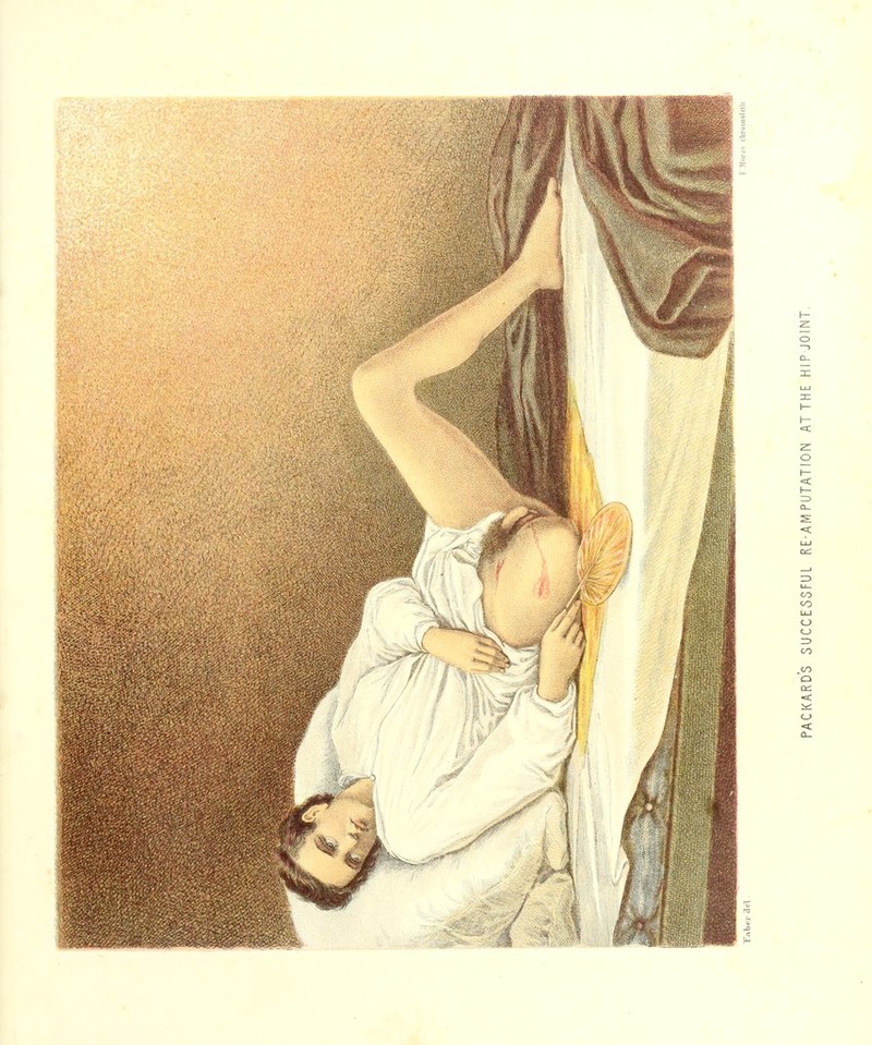 —5 Q— X o I— UJ CO <o O o .to o < <