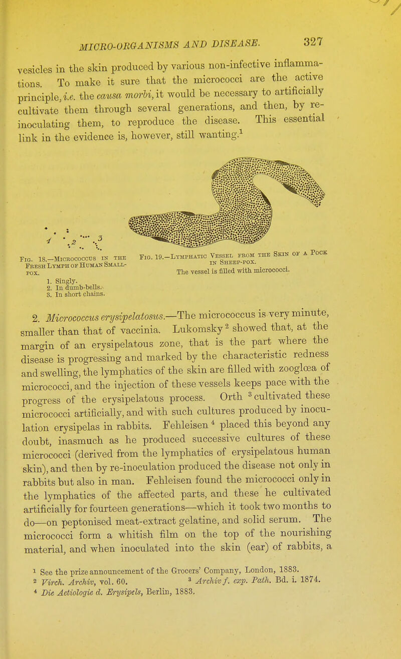 vesicles in the skin produced by various non-infective inflamma- tions. To make it sure that the micrococci are the active principle., i.e. the cairn morbi, it would be necessary to artificially cultivate'them through several generations, and then, by re- inoculating them, to reproduce the disease. This essential link in the evidence is, however, still wanting.1 Fig. 18.-Micbococc,sin thE Fig. 19,-Lymphatic Vessel ebom the Skin ok a Pock Fresh Lymph of Human Small- in bHEEP-POX. _ Pox. The vessel is filled with micrococci. 1. Singly. 2. In dumb-bells. 3. In short chains. 2. Micrococcus erysipelatous —-The micrococcus is very minute, smaller than that of vaccinia. Lukomsky 2 showed that, at the margin of an erysipelatous zone, that is the part where the disease is progressing and marked by the characteristic redness and swelling, the lymphatics of the skin are filled with zoogloea of micrococci, and the injection of these vessels keeps pace with the progress of the erysipelatous process. Orth 3 cultivated these micrococci artificially, and with such cultures produced by inocu- lation erysipelas in rabbits. Fehleisen4 placed this beyond any doubt, inasmuch as he produced successive cultures of these micrococci (derived from the lymphatics of erysipelatous human skin), and then by re-inoculation produced the disease not only in rabbits but also in man. Fehleisen found the micrococci only in the lymphatics of the affected parts, and these he cultivated artificially for fourteen generations—which it took two months to do—on peptonised meat-extract gelatine, and solid serum. The micrococci form a whitish film on the top of the nourishing material, and when inoculated into the skin (ear) of rabbits, a 1 See the prize announcement of the Grocers' Company, London, 1883. 2 Virch. ArcHv, vol. 60. 3 Archivf. exp. Path. Bd. i. 1874. * Die Aetiologie d. Erysipcls, Berlin, 1883.