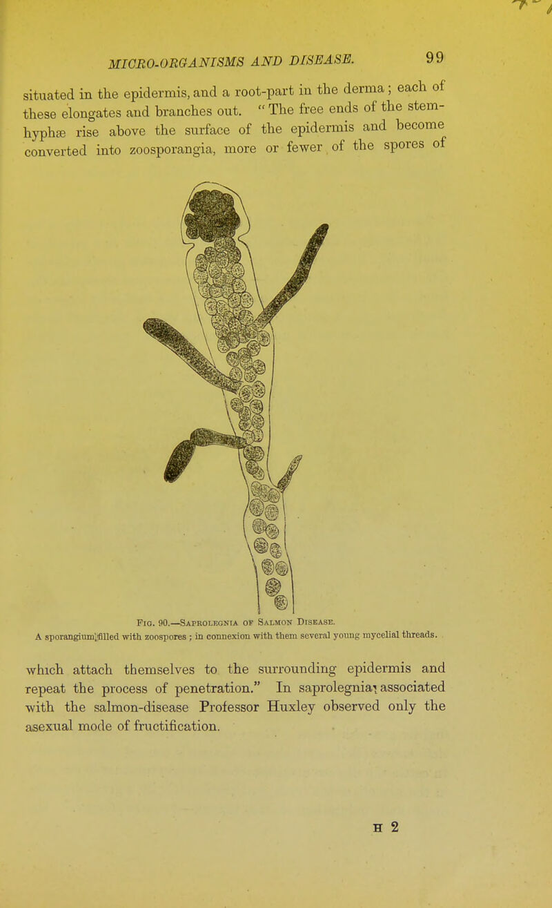 situated in the epidermis, and a root-part in the derma; each of these elongates and branches out.  The free ends of the stem- hyphse rise above the surface of the epidermis and become converted into zoosporangia, more or fewer of the spores of Fio. 90.—Saprolecnia of Salmon Disease. A sporangium^lled with zoospores ; in connexion with them several young mycelial threads. which attach themselves to the surrounding epidermis and repeat the process of penetration. In saprolegniai associated with the salmon-disease Professor Huxley observed only the asexual mode of fructification.