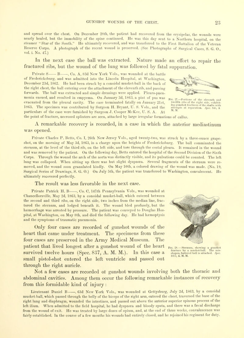 Fro. 27.—Portions of the eleventh and twelfth ribs of the right side, exhibit- ing gunshot fractures of the shafts with attempts at reparation. Spec. 845, A M. M. and spread over the chest. On December 28th, the patient had recovered from the erysipelas, the wounds were nearly healed, but the immobility of the spine continued. He was this day sent to a Northern hospital, on the steamer  Star of the South. He ultimately recovered, and was transferred to the First Battalion of the Veteran Reserve Corps. A photograph of the recent wound is preserved. (See Photographs of Surgical Oases, S. G. 0., vol. i. No. 47.) In the next case the ball was extracted. Nature made an effort to repair the fractured ribs, but the wound of the lung was followed by fatal suppuration. Private S B , Co. A, 83d New York Vols., was wounded at the battle of Fredericksburg, and was admitted into the Lincoln Hospital, at Washington, December 23d, 1862. He had been struck by a conoidal musket-ball in the back of the right chest, the ball entering over the attachment of the eleventh rib, and passing forwards. The ball was extracted and simple dressings were applied. Pleuro-pneu- monia ensued, and resulted in empyema. On January 3d, 1863, a pint of pus was evacuated from the pleural cavity. The case termiuated fatally on January 21st, 1863. The specimen was contributed by Surgeon H. Bryant, U. S. Vols., and the particulars of the case were furnished by Surgeon J. Cooper McKee, U. S. A. At the point of fracture, necrosed splinters are seen, attached by large irregular formations of callus. A remarkable recovery is recorded, in a case in which the anterior mediastinum was opened. Private Charles P. Betts, Co. I, 26th New Jersey Vols., aged twenty-two, was struck by a three-ounce grape- shot, on the morning of May 3d, 1863, in a charge upon the heights of Fredericksburg. The ball comminuted the sternum, at the level of the third rib, on the left side, and tore through the costal pleura. It remained in the wound and was removed by the patient. On the following day, Betts entered the hospital of the Second Division of the Sixth Corps. Through the wound the arch of the aorta was distinctly visible, and its pulsations could be counted. The left lung was collapsed. When sitting up there was but slight dyspnoea. Several fragments of the sternum were re- moved, and the wound soon granulated kindly. On May 10th, a colored drawing of the wound was made. (No. 19, Surgical Series of Drawings, S. G. 0.) On July 5th, the patient was transferred to Washington, convalescent. He ultimately recovered perfectly. The result was less favorable in the next case. Private Patrick H. B , Co. C, 147th Pennsylvania Vols., was wounded at Chancellorsville, May 2d, 1863, by a conoidal musket-ball, which entered between the second and third ribs, on the right side, two inches from the median line, frac- tured the sternum, and lodged beneath it. The wound bled profusely, but the ha;morrhage was arrested by pressure. The patient was conveyed to Douglas Hos- pital, at Washington, on May 8th, and died the following day. He had hemoptysis and the symptoms of traumatic pneumonia. Only four cases are recorded of gunshot wounds of the heart that came under treatment. The specimens from these four cases are preserved in the Army Medical Museum. The patient that lived longest after a gunshot wound of the heart survived twelve hours (Spec. 837, A. M. M.). In this case a small pistol-shot entered the left ventricle and passed out through the right auricle. Not a few cases are recorded of gunshot wounds involving both the thoracic and abdominal cavities. Among them occur the following remarkable instances of recovery from this formidable kind of injury : Lieutenant Daniel B , 63d New York Vols., was wounded at Gettysburg, July 2d, 1863, by a conoidal musket-ball, which passed through the belly of the biceps of the right arm, entered the chest, traversed the base of the right lung and diaphragm, wounded the intestines, and passed out above the anterior superior spinous process of the left ilium. When admitted to the field hospital, he had dyspnoea and bloody sputa, and there was a faecal discharge from the wound of exit. He was treated by large doses of opium, and, at the end of three weeks, convalescence was fairly established. In the course of a few months his wounds had entirely closed, and he rejoined his regiment for duty. Flu. 28. — Sternum, showing a gunshot fracture by a musket-ball. The mis- shapen, battered ball is attached. Spec. 1073, A. M. M.