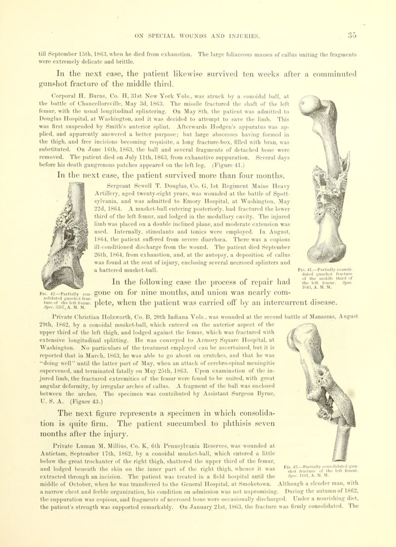 till September 15th, 1863, when he died from exhaustion. The large foliaceous masses of callus uniting the fragments were extremely delicate and brittle. In the next case, the patient likewise survived ten weeks after a comminuted gunshot fracture of the middle third. Corporal H. Burns, Co. H, 31st New York Vols., was struck by a conoidal ball, at the battle of Chancellorsville, May 3d, 18G3. The missile fractured the shaft of the left femur, with the usual longitudinal splintering. On May 8th, the patient was admitted to Douglas Hospital, at Washington, and it was decided to attempt to save the limb. This was first suspended by Smith's anterior splint. Afterwards Hodgen's apparatus was ap- plied, and apparently answered a better purpose; but large abscesses having formed in the thigh, and free incisions becoming requisite, a long fracture-box, filled with bran, was substituted. On June 16th, 1863, the ball and several fragments of detached bone were removed. The patient died on July 11th, 1863, from exhaustive suppuration. Several days before his death gangrenous patches appeared on the left leg. (Figure 41.) In the next case, the patient survived more than four months. Sergeant Sewell T. Douglas, Co. G, 1st Regiment Maine Heavy Artillery, aged twenty-eight years, was wounded at the battle of Spott- sylvania, and was admitted to Emory Hospital, at Washington, May 22d, 1864. A nmsket-ball entering posteriorly, had fractured the lower third of the left femur, and lodged in the medullary cavity. The injured limb was placed on a double iuclined plane, and moderate extension was used. Internally, stimulants and tonics were employed. In August, 1864, the patient suffered from severe diarrhoea. There was a copious ill-conditioned discharge from the wound. The patient died September 26th, 1864, from exhaustion, and, at the autopsy, a deposition of callus was found at the seat of injury, enclosing several necrosed splinters and a battered musket-ball. Partially consoli- dated gunshot fracture of the middle third (if the left femur. Spec. 1643, A. M. M. 42—Partially con- solidated gunshot frac- ture of the left fernur. Spec. 32C7, A. M. M. In the following case the process of repair had gone on for nine months, and union was nearly com- plete, when the patient was carried off by an intercurrent disease. Private Christian Ilolzworth, Co. B, 20th Indiana Vols., was wounded at the second battle of Manassas, August 20th, 1862, by a conoidal musket-ball, which entered on the anterior aspect of the upper third of the left thigh, and lodged against the femur, which was fractured with extensive longitudinal splitting. He was conveyed to Armory Square Hospital, at Washington. No particulars of the treatment employed can be ascertained, but it is reported that in March, 1863, he was able to go about on crutches, and that he was doing well until the latter part of May, when an attack of cerebro-spinal meningitis supervened, and terminated fatally on May 25th, 1863. Upon examination of the in- jured limb, the fractured extremities of the femur were found to be united, with great angular deformity, by irregular arches of callus. A fragment of the ball was enclosed between the arches. The specimen was contributed by Assistant Surgeon Byrne, U. S. A. (Figure 43.) The next figure represents a specimen in which consolida- tion is quite firm. The patient succumbed to phthisis seven months after the injury. Private Luman M. Millius, Co. K, 6th Pennsylvania Reserves, was wounded at Antietam, September L7th, 1862, by a conoidal musket-ball, which entered a little below the great trochanter of the right thigh, shattered the upper third of the femur, and lodged beneath the skin on the inner part of the right thigh, whence it was extracted through an incision. The patient was treated in a field hospital until the middle of October, when he was transferred to the General Hospital, at Smoketown. Although a slender man, with a narrow chest and feeble organization, his condition on admission was not unpromising. During the autumn of 1862, the suppuration was copious, and fragments of necrosed bone were occasionally discharged. Under a nourishing diet, the patient's strength was supported remarkably. On January 21st, 1863, the fracture was firmly consolidated. The Fig. 43.—Partially consolidated pun- shot fracture of the left femur. Spec. 11(31, A. M. M.