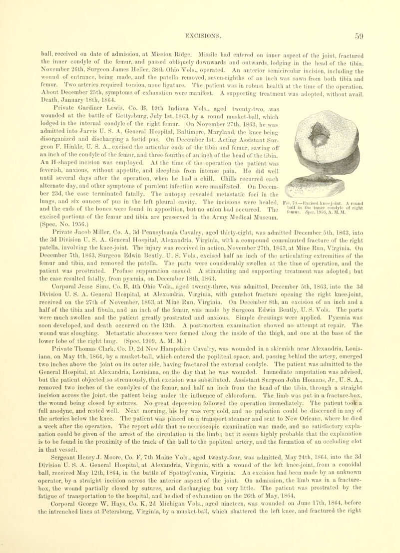 ball, received on date of admission, at Mission Ridge. Missile had entered on inner aspect of the joint, fractured the inner condyle of the femur, and passed obliquely downwards and outwards, lodging in the head of the tibia. November 26th, Surgeon James Heller, 38th Ohio Vols., operated. An anterior semicircular incision, including the wound of entrance, being made, and the patella removed, seven-eighths of an inch was sawn from both tibia and femur. Two arteries required torsion, none ligature. The patient was in robust health at the time of the operation. About December 25th, symptoms of exhaustion were manifest. A supporting treatment was adopted, without avail. Death, January 18th, 1864. Private Gardiner Lewis, Co. B, 19th Indiana Vols., aged twenty-two, was wounded at the battle of Gettysburg, July 1st, 1863, by a round musket-ball, which lodged in the internal condyle of the right femur. On November 27th, 1863, he was admitted into Jarvis U. S. A. General Hospital, Baltimore, Maryland, the knee being disorganized and discharging a foetid pus. On December 1st, Acting Assistant Sur- geon F. Hinkle, U. S. A., excised the articular ends of the tibia and femur, sawing off an inch of the condyle of the femur, and three-fourths of an inch of the head of the tibia. An H-shaped incision was employed. At the time of the operation the patient was feverish, anxious, without appetite, and sleepless from intense pain. He did well until several days after the operation, when he had a chill. Chills recurred each alternate day, and other symptoms of purulent infection were manifested. On Decem- ber 23d, the case terminated fatally. The autopsy revealed metastatic foci in the lungs, and six ounces of pus in the left pleural cavity. The incisions were healed, Via. io.—Excised knee-j.>int. A round and the ends of the bones were found in apposition, but no union had occurred. The J^'u,in a^/m' dsht excised portions of the femur and tibia are preserved in the Army Medical Museum. (Spec. No. 1956.) Private Jacob Miller, Co. A, 3d Pennsylvania Cavalry, aged thirty-eight, was admitted December 5th, 1863, into the 3d Division U. S. A. General Hospital, Alexandria, Virginia, with a compound comminuted fracture of the right patella, involving the knee-joint. The injury was received in action, November 27th, 1863, at Mine Run, Virginia. On December 7th, 1863, Surgeon Edwin Bently, U. S. Vols., excised half an inch of the articulating extremities of the femur and tibia, and removed the patella. The parts were considerably swollen at the time of operation, and the patient was prostrated. Profuse suppuration ensued. A stimulating and supporting treatment was adopted; but the case resulted fatally, from pyaemia, on December 18th, 1863. Corporal Jesse Sims, Co. B, 4th Ohio Vols., aged twenty-three, was admitted, December 5th, 1863, into the 3d Division TJ. S. A. General Hospital, at Alexandria, Virginia, with gunshot fracture opening the right knee-joint, received on the 27th of November, 1863, at Mine Run, Virginia. On December 8th, an excision of an inch and a half of the tibia and fibula, and an inch of the femur, was made by Surgeon Edwin Bently, U.S. Vols. The parts were much swollen and the patient greatly prostrated and anxious. Simple dressings were applied. Pyasmia was soon developed, and death occurred on the 13th. A post-mortem examination showed no attempt at repair. The wound was sloughing. Metastatic abscesses were formed along the inside of the thigh, and one at the base of the lower lobe of the right lung. (Spec. 1909, A. M. M.) Private Thomas Clark, Co. D, 2d New Hampshire Cavalry, was wounded in a skirmish near Alexandria, Louis- iana, on May 4th, 1864, by a musket-ball, which entered the popliteal space, and, passing behind the artery, emerged two inches above the joint on its outer side, having fractured the external condyle. The patient was admitted to the General Hospital, at Alexandria, Louisiana, on the day that he was wounded. Immediate amputation was advised, but the patient objected so strenuously, that excision was substituted. Assistant Surgeon John Homans, Jr., U. S. A., removed two inches of the condyles of the femur, and half an inch from the head of the tibia, through a straight incision across the joint, the patient being under the influence of chloroform. The limb was put in a fracture-box, the wound being closed by sutures. No great depression followed the operation immediately. The patient took a full anodyne, and rested well. Next morning, his leg was very cold, and no pulsation could be discerned in any of the arteries below the knee. The patient was placed on a transport steamer and sent to New Orleans, where he died a week after the operation. The report adds that no necroscopic examination was made, and no satisfactory expla- nation could be given of the arrest of the circulation in the limb; but it seems highly probable that the explanation is to be found in the proximity of the track of the ball to the popliteal artery, and the formation of an occluding clot in that vessel. Sergeant Henry J. Moore, Co. F, 7th Maine Vols., aged twenty-four, was admitted, May 24th, 1864, into the 3d Division U. S. A. General Hospital, at Alexandria, Virginia, with a wound of the left knee-joint, from a conoidal ball, received May 12th, 1864, in the battle of Spottsylvania, Virginia. An excision had been made by an unknown operator, by a straight incision across the anterior aspect of the joint. On admission, the limb was in a fracture- box, the wound partially closed by sutures, and discharging but very little. The patient was prostrated by the fatigue of transportation to the hospital, and he died of exhaustion on the 26th of May, 1864. Corporal George W. Hays, Co. K, 2d Michigan Vols., aged nineteen, was wounded on June 17th, 1864, before the intrenched lines at Petersburg, Virginia, by a musket-ball, which shattered the left knee, and fractured the right