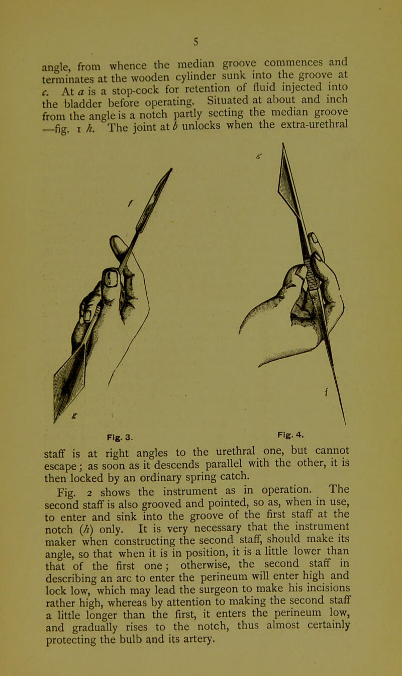 s angle from whence the median groove commences and terminates at the wooden cylinder sunk into the groove at c. At a is a stop-cock for retention of fluid injected into the bladder before operating. Situated at about and inch from the angle is a notch partly secting the median groove —fig i h. The joint at b unlocks when the extra-urethral Fig. 3. F|e-4- staff is at right angles to the urethral one, but cannot escape; as soon as it descends parallel with the other, it is then locked by an ordinary spring catch. Fig. 2 shows the instrument as in operation. The second staff is also grooved and pointed, so as, when in use, to enter and sink into the groove of the first staff at the notch (A) only. It is very necessary that the instrument maker when constructing the second staff, should make its angle, so that when it is in position, it is a little lower than that of the first one; otherwise, the second staff in describing an arc to enter the perineum will enter high and lock low, which may lead the surgeon to make his incisions rather high, whereas by attention to making the second staff a little longer than the first, it enters the perineum low, and gradually rises to the notch, thus almost certainly protecting the bulb and its artery.