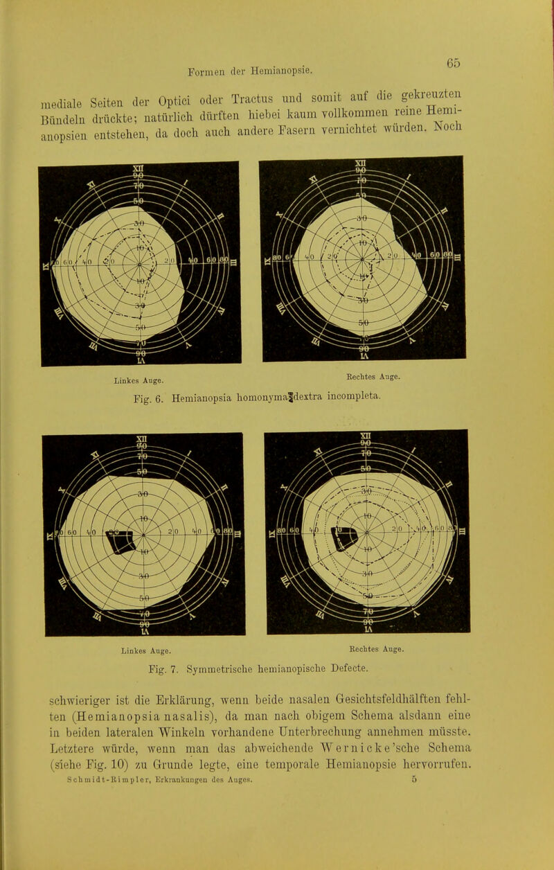 mediale Seiten der Optici oder Tractus und somit auf die gekreuzten Bündeln drückte; natürlich dürften hiebei kaum vollkommen reine Hemi- anopsien entstehen, da doch auch andere Fasern vernichtet würden. Noch Linkes Auge. Rechtes Auge. Fig. 6. Hemianopsia liomonyma^dextra incompleta. Linkes Auge. Rechtes Auge. Fig. 7. Symmetrische hemianopische Defecte. schwieriger ist die Erklärung, wenn beide nasalen Gesichtsfeldhälften fehl- ten (Hemianopsia nasalis), da man nach obigem Schema alsdann eine in beiden lateralen Winkeln vorhandene Unterbrechung annehmen müsste. Letztere würde, wenn man das abweichende Wer nicke'sehe Schema (siehe Fig. 10) zu Grunde legte, eine temporale Hemianopsie hervorrufen. Schmidt-Rirapler, Erkrankungen dos Auges. 5
