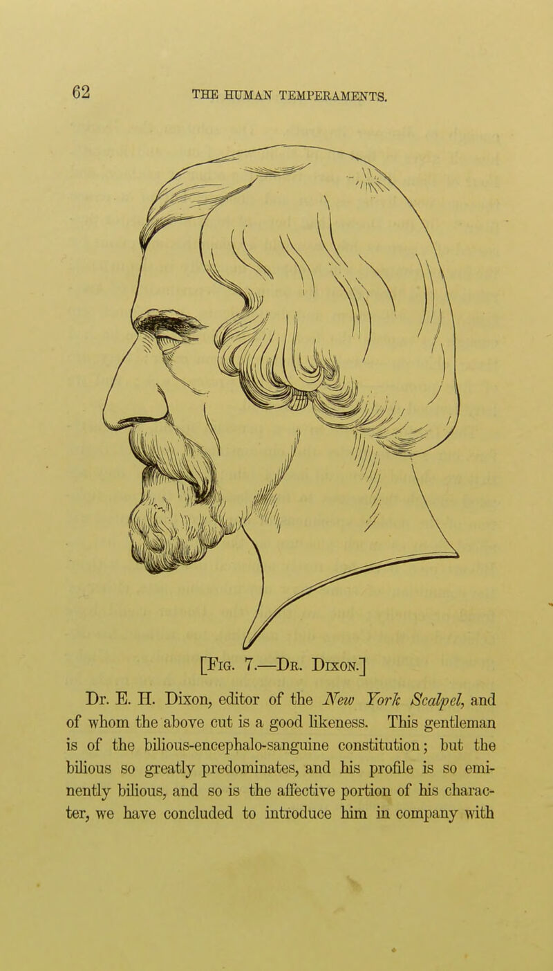 [Fig. 7.—Dr. Dixon.] Dr. E. H. Dixon, editor of the New York Scalpel, and of whom the above cut is a good hkeness. This gentleman is of the bilious-encephalo-sanguine constitution; but the bilious so greatly predominates, and his profile is so emi- nently bilious, and so is the affective portion of his charac- ter, we have concluded to introduce him in company with