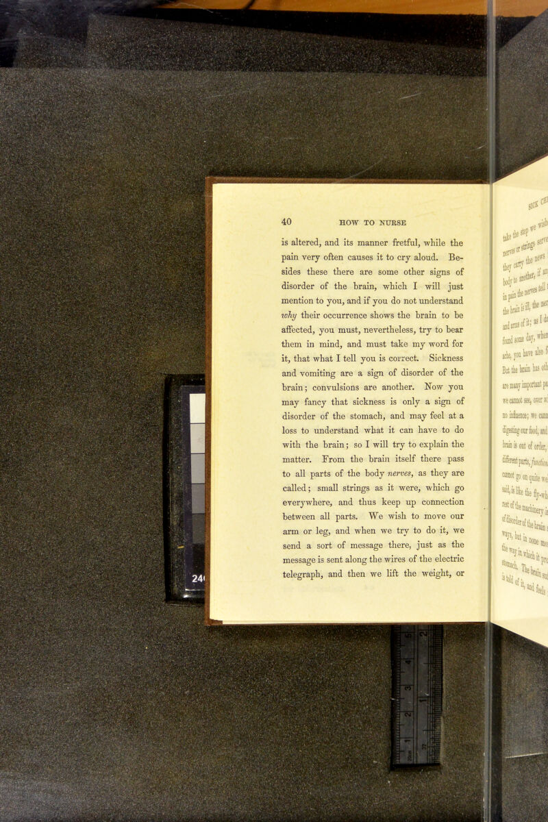 is altered, and its manner fretful, while the pain very often causes it to cry aloud. Be- sides these there are some other signs of disorder of the brain, which I will just mention to you, and if you do not understand why their occurrence shows the brain to be affected, you must, nevertheless, try to bear them in mind, and must take my word for it, that what I tell you is correct. Sickness and vomiting are a sign of disorder of the brain; convulsions are another. Now you may fancy that sickness is only a sign of disorder of the stomach, and may feel at a loss to understand what it can have to do with the brain; so I will try to explain the matter. From the brain itself there pass to all parts of the body nerves, as they are called; small strings as it were, which go everywhere, and thus keep up connection between all parts. We wish to move our arm or leg, and when we try to do it, we send a sort of message there, just as the message is sent along the wires of the electric telegraph, and then we lift the weight, or
