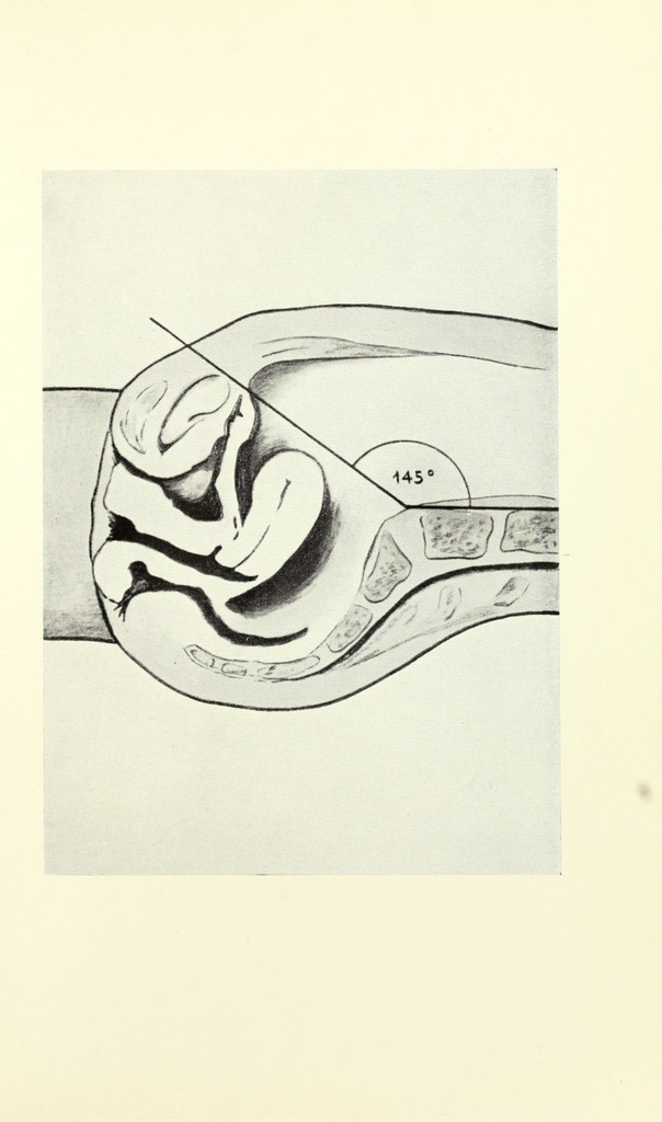 link to previous page