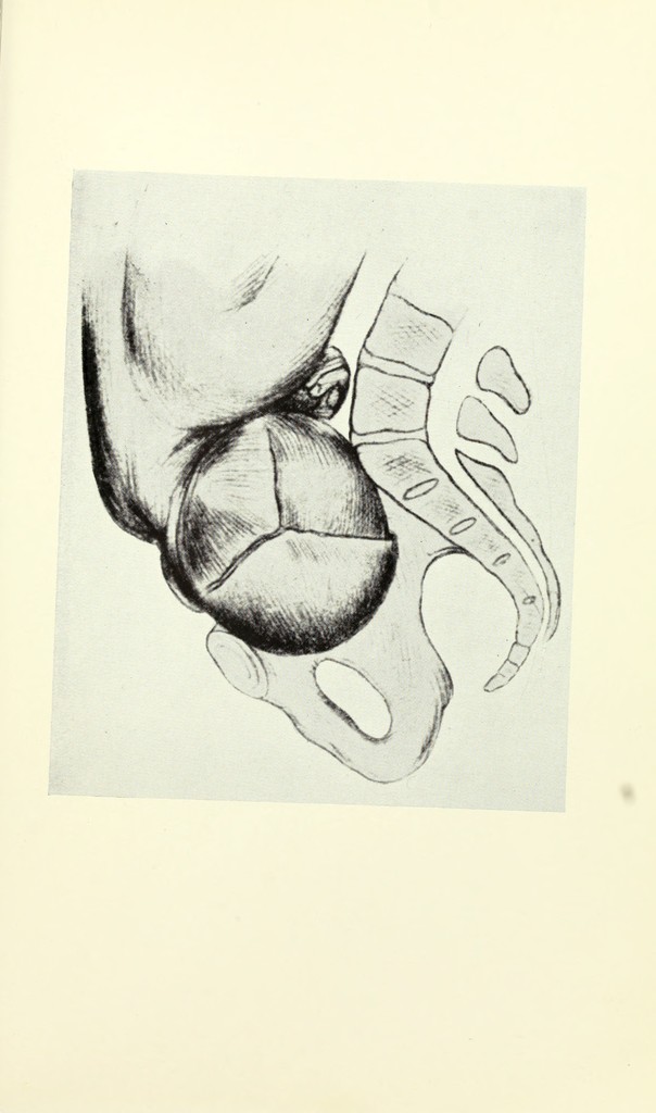 link to previous page
