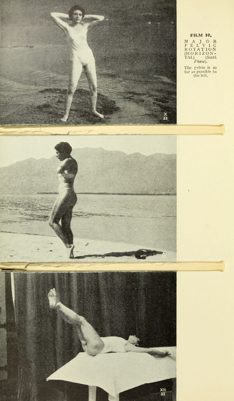 ROTATION (HORIZON- TAL) (Sixth Phase). The pel vis is as far as possible to the left.