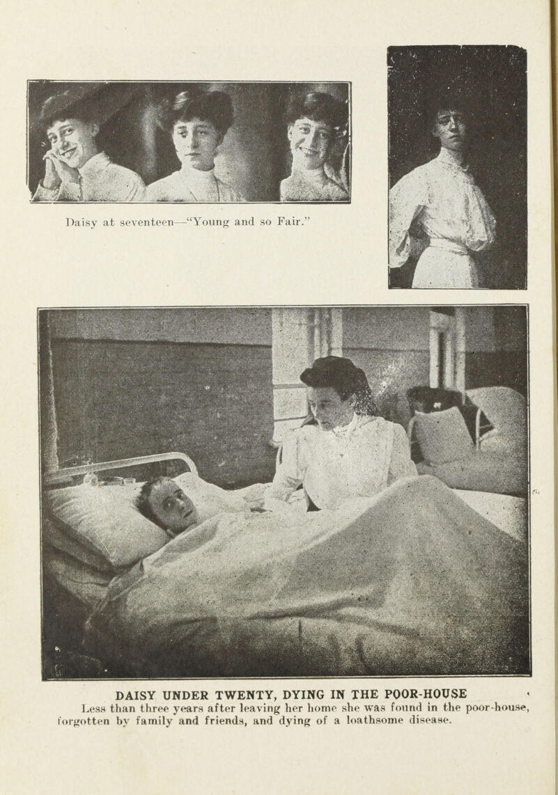  BAO RSS DAISY UNDER TWENTY, DYING IN THE POOR-HOUSE ‘ Less than three years after leaving her home she was found in the poor-house, forgotten by family and friends, and dying of a loathsome disease.