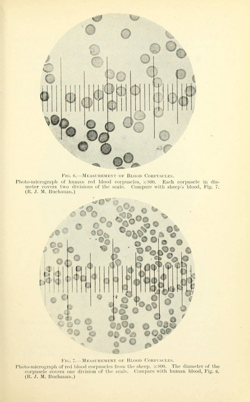 o O f| Per ? o ■ Fig. 6.—Measurement of Blood Corpuscles. Photo-micrograph of human red blood corpuscles, xSOO. Each corpuscle in di;i meter covers two divisions of the scale. Compare with sheep's blood, Fig. 1 (R. J. M. Buchanan.) c oa 3 o a? Pig, 7.—Measurement of Blood Corpuscles. Photo-micrograph of red blood corpuscles from the sheep, xSOO. The diameter of the corpuscle covers one division of the scale. Compare with human blood, Fig. 6. (K. J. M. Buchanan.)