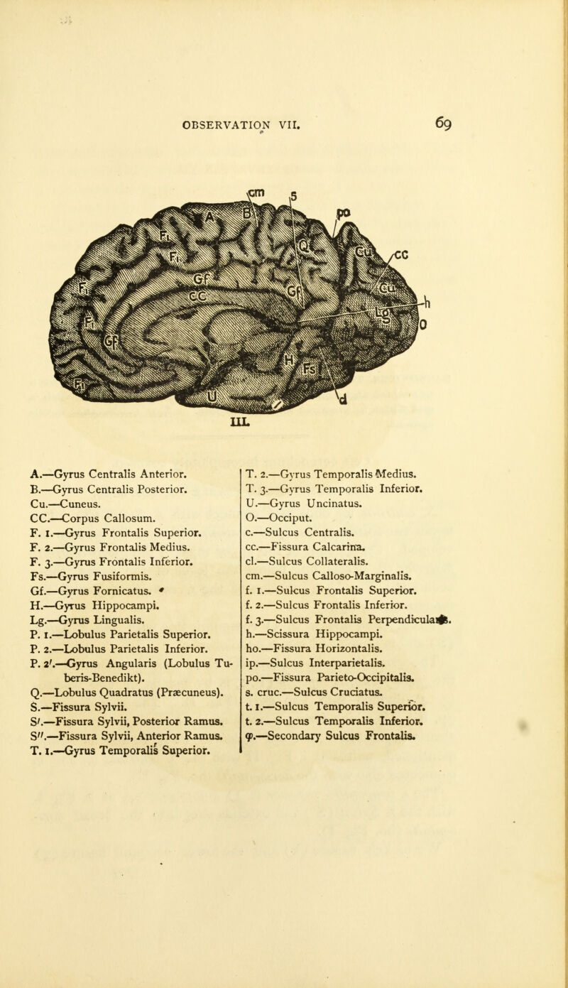 UL A. —Gyrus Centralis Anterior. B. —Gyrus Centralis Posterior. Cu.—Cuneus. CC.—Corpus Callosum. F. I.—Gyrus Frontalis Superior. F. 2.—Gyrus Frontalis Medius. F. 3.—Gyrus Frontalis Inferior. Fs.—Gyrus Fusiformis. Gf.—Gyrus Fornicatus. * H.—Gyrus Hippocampi. Lg.—Gyrus Lingualis. P. I.—Lobulus Parietalis Superior. P. 2.—Lobulus Parietalis Inferior. P. 2'.—Gyrus Angularis (Lobulus Tu- beris-Benedikt). Q.—Lobulus Quadratus (Praecuneus). $.—Fissura Sylvii. S'.—Fissura Sylvii, Posterior Ramus. S.—Fissura Sylvii, Anterior Ramus. T. i.—Gyrus Temporalis Superior. T. 2.—Gyrus Temporalis Medius. T. 3.—Gyrus Temporalis Inferior. U.—Gyrus Uncinatus. O.—Occiput. c.—Sulcus Centralis. cc.—Fissura Calcarina. cl.—Sulcus Collateralis. cm.—Sulcus Calloso-Marginalis. f. 1.—Sulcus Frontalis Superior. f. 2.—Sulcus Frontalis Inferior. f. 3.—Sulcus Frontalis Perpendiculars. h.—Scissura Hippocampi. ho.—Fissura Horizontalis. ip.—Sulcus Interparietalis. po.—Fissura Parieto-Occipitalis. s. cruc.—Sulcus Cruciatus. 1.1.—Sulcus Temporalis Superior. t. 2.—Sulcus Temporalis Inferior. <p.—Secondary Sulcus Frontalis.