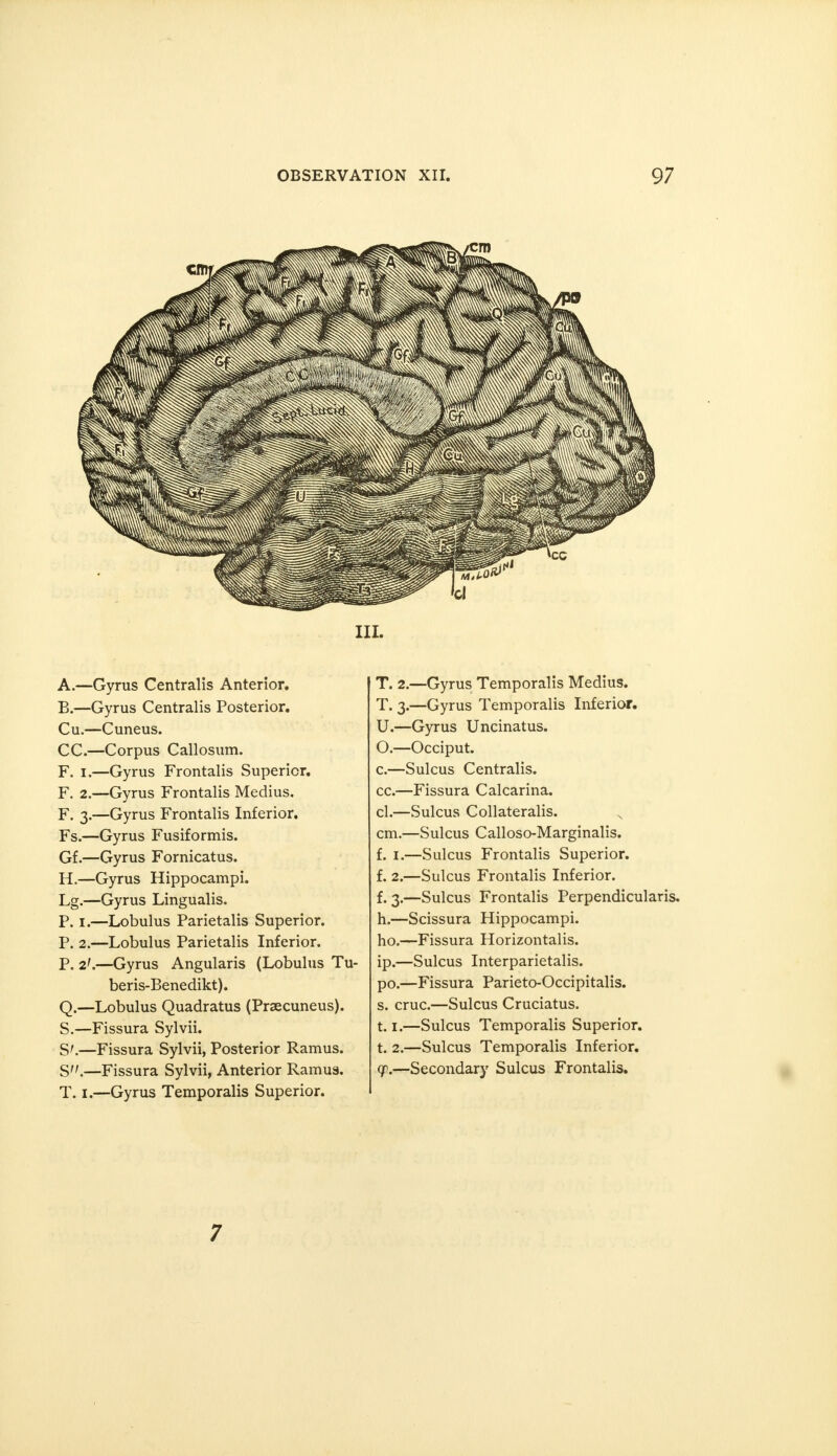 ill. A. —Gyrus Centralis Anterior. B. —Gyrus Centralis Posterior. Cu.—Cuneus. CC.—Corpus Callosum. F. I.—Gyrus Frontalis Superior. F. 2.—Gyrus Frontalis Medius. F. 3.—Gyrus Frontalis Inferior. Fs.—Gyrus Fusiformis. Gf.—Gyrus Fornicatus. H.—Gyrus Hippocampi. Lg.—Gyrus Lingualis. P. i.—Lobulus Parietalis Superior. P. 2.—Lobulus Parietalis Inferior. P. 2'.—Gyrus Angularis (Lobulus Tu- beris-Benedikt). Q.—Lobulus Quadratus (Precuneus). S.—Fissura Sylvii. S'.—Fissura Sylvii, Posterior Ramus. S.—Fissura Sylvii, Anterior Ramus. T. 1.—Gyrus Temporalis Superior. T. 2.—Gyrus Temporalis Medius. T. 3.—Gyrus Temporalis Inferior. U.—Gyrus Uncinatus. O.—Occiput. c.—Sulcus Centralis. cc.—Fissura Calcarina. cl.—Sulcus Collateralis. cm.—Sulcus Calloso-Marginalis. f. 1.—Sulcus Frontalis Superior. f. 2.—Sulcus Frontalis Inferior. f. 3.—Sulcus Frontalis Perpendicularis. h.—Scissura Hippocampi. ho.—Fissura Horizontalis. ip.—Sulcus Interparietalis. po.—Fissura Parieto-Occipitalis. s. cruc.—Sulcus Cruciatus. 1.1.—Sulcus Temporalis Superior. t. 2.—Sulcus Temporalis Inferior. gp.—Secondary Sulcus Frontalis. 7