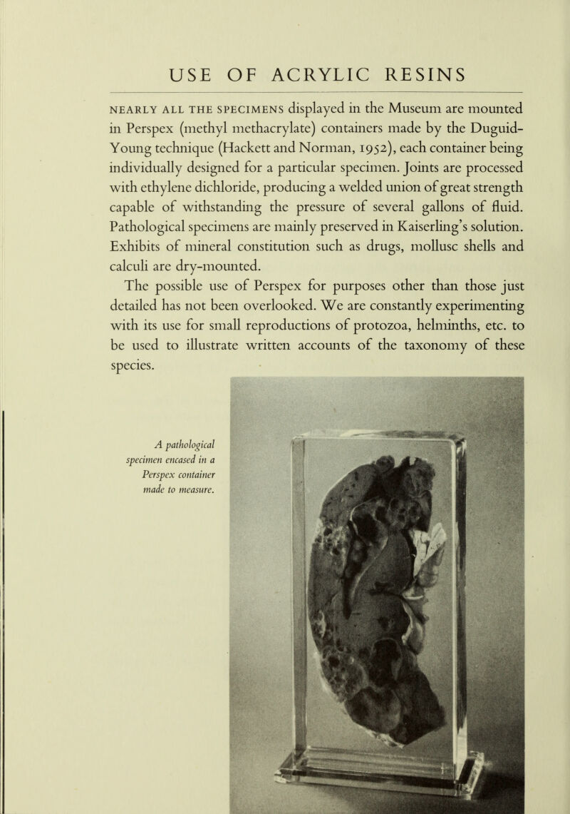 USE OF ACRYLIC RESINS nearly all the specimens displayed in the Museum are mounted in Perspex (methyl methacrylate) containers made by the Duguid- Young technique (Hackett and Norman, 1952), each container being individually designed for a particular specimen. Joints are processed with ethylene dichloride, producing a welded union of great strength capable of withstanding the pressure of several gallons of fluid. Pathological specimens are mainly preserved in Kaiserling's solution. Exhibits of mineral constitution such as drugs, mollusc shells and calculi are dry-mounted. The possible use of Perspex for purposes other than those just detailed has not been overlooked. We are constantly experimenting with its use for small reproductions of protozoa, helminths, etc. to be used to illustrate written accounts of the taxonomy of these species. A pathological specimen encased in a Perspex container made to measure.