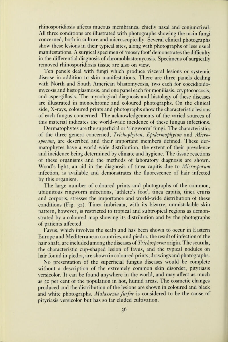 rhinosporidiosis affects mucous membranes, chiefly nasal and conjunctival. All three conditions are illustrated with photographs showing the main fungi concerned, both in culture and microscopically. Several clinical photographs show these lesions in their typical sites, along with photographs of less usual manifestations. A surgical specimen of'mossy foot' demonstrates the difficulty in the differential diagnosis of chromoblastomycosis. Specimens of surgically removed rhinosporidiosis tissue are also on view. Ten panels deal with fungi which produce visceral lesions or systemic disease in addition to skin manifestations. There are three panels dealing with North and South American blastomycosis, two each for coccidioido- mycosis and histoplasmosis, and one panel each for moniliasis, cryptococcosis, and aspergillosis. The mycological diagnosis and histology of these diseases are illustrated in monochrome and coloured photographs. On the clinical side, X-rays, coloured prints and photographs show the characteristic lesions of each fungus concerned. The acknowledgements of the varied sources of this material indicates the world-wide incidence of these fungus infections. Dermatophytes are the superficial or 'ringworm' fungi. The characteristics of the three genera concerned, Trichophyton, Epidermophyton and Micro- sporum, are described and their important members defined. These der- matophytes have a world-wide distribution, the extent of their prevalence and incidence being determined by climate and hygiene. The tissue reactions of these organisms and the methods of laboratory diagnosis are shown. Wood's light, an aid in the diagnosis of tinea capitis due to Microsporum infection, is available and demonstrates the fluorescence of hair infected by this organism. The large number of coloured prints and photographs of the common, ubiquitous ringworm infections, 'athlete's foot', tinea capitis, tinea cruris and corporis, stresses the importance and world-wide distribution of these conditions (Fig. 32). Tinea imbricata, with its bizarre, unmistakable skin pattern, however, is restricted to tropical and subtropical regions as demon- strated by a coloured map showing its distribution and by the photographs of patients affected. Favus, which involves the scalp and has been shown to occur in Eastern Europe and Mediterranean countries, and piedra, the result of infection of the hair shaft, are included among the diseases of Trichosporon origin. The scutula, the characteristic cup-shaped lesion of favus, and the typical nodules on hair found in piedra, are shown in coloured prints, drawings and photographs. No presentation of the superficial fungus diseases would be complete without a description of the extremely common skin disorder, pityriasis versicolor. It can be found anywhere in the world, and may affect as much as 50 per cent of the population in hot, humid areas. The cosmetic changes produced and the distribution of the lesions are shown in coloured and black and white photographs. Malassezia furfur is considered to be the cause of pityriasis versicolor but has so far eluded cultivation.