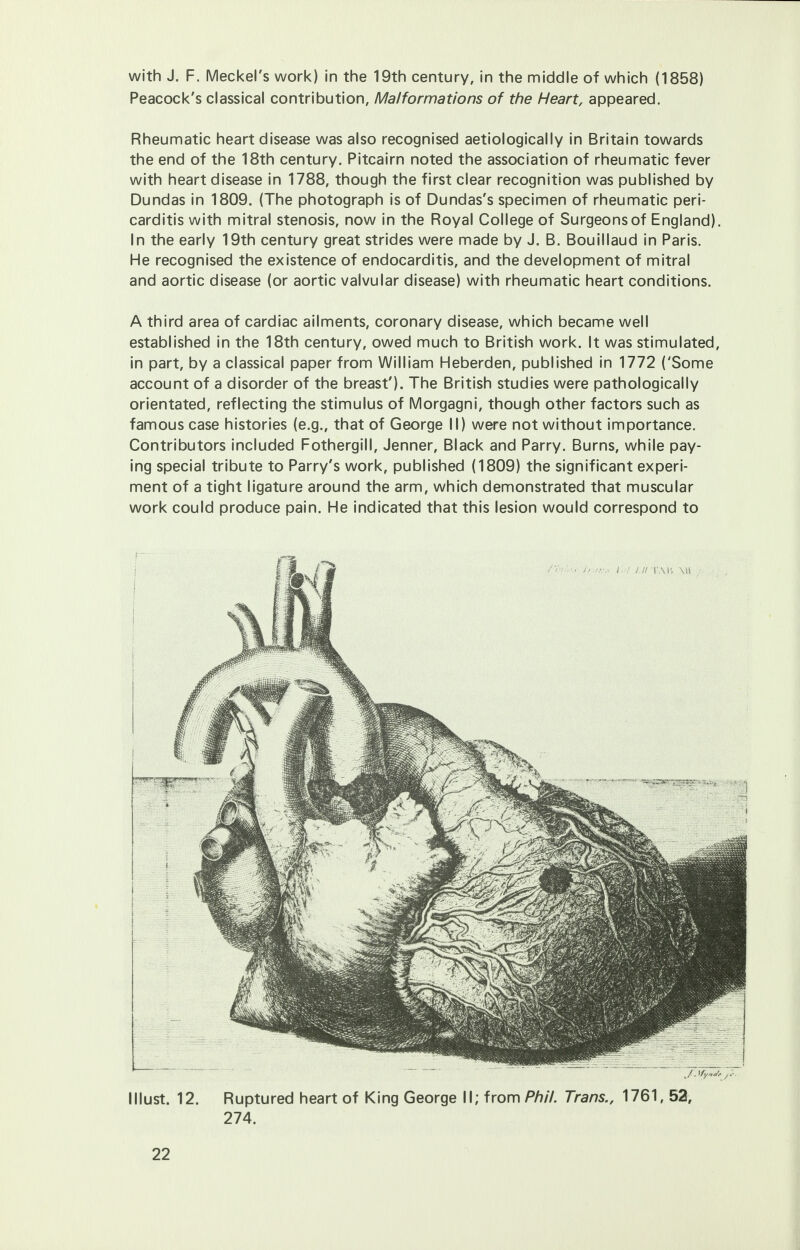 with J. F. Meckel's work) in the 19th century, in the middle of which (1858) Peacock's classical contribution, Malformations of the Heart, appeared. Rheumatic heart disease was also recognised aetiologically in Britain towards the end of the 18th century. Pitcairn noted the association of rheumatic fever with heart disease in 1788, though the first clear recognition was published by Dundas in 1809. (The photograph is of Dundas's specimen of rheumatic peri- carditis with mitral stenosis, now in the Royal College of Surgeons of England). In the early 19th century great strides were made by J. B. Bouillaud in Paris. He recognised the existence of endocarditis, and the development of mitral and aortic disease (or aortic valvular disease) with rheumatic heart conditions. A third area of cardiac ailments, coronary disease, which became well established in the 18th century, owed much to British work. It was stimulated, in part, by a classical paper from William Heberden, published in 1772 ('Some account of a disorder of the breast'). The British studies were pathologically orientated, reflecting the stimulus of Morgagni, though other factors such as famous case histories (e.g., that of George II) were not without importance. Contributors included Fothergill, Jenner, Black and Parry. Burns, while pay- ing special tribute to Parry's work, published (1809) the significant experi- ment of a tight ligature around the arm, which demonstrated that muscular work could produce pain. He indicated that this lesion would correspond to