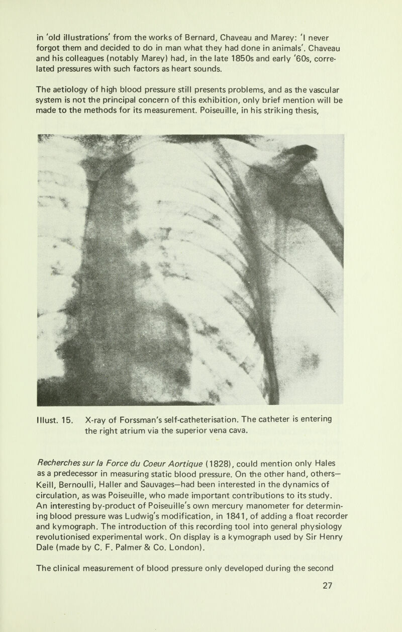 in 'old illustrations' from the works of Bernard, Chaveau and Marey: 'I never forgot them and decided to do in man what they had done in animals'. Chaveau and his colleagues (notably Marey) had, in the late 1850s and early '60s, corre- lated pressures with such factors as heart sounds. The aetiology of high blood pressure still presents problems, and as the vascular system is not the principal concern of this exhibition, only brief mention will be made to the methods for its measurement. Poiseuille, in his striking thesis, I Must. 15. X-ray of Forssman's self-catheterisation. The catheter is entering the right atrium via the superior vena cava. Recherches sur la Force du Coeur Aortique (1828), could mention only Hales as a predecessor in measuring static blood pressure. On the other hand, others— Keill, Bernoulli, Haller and Sauvages—had been interested in the dynamics of circulation, as was Poiseuille, who made important contributions to its study. An interesting by-product of Poiseuille's own mercury manometer for determin- ing blood pressure was Ludwig's modification, in 1841, of adding a float recorder and kymograph. The introduction of this recording tool into general physiology revolutionised experimental work. On display is a kymograph used by Sir Henry Dale (made by C. F. Palmer & Co. London). The clinical measurement of blood pressure only developed during the second